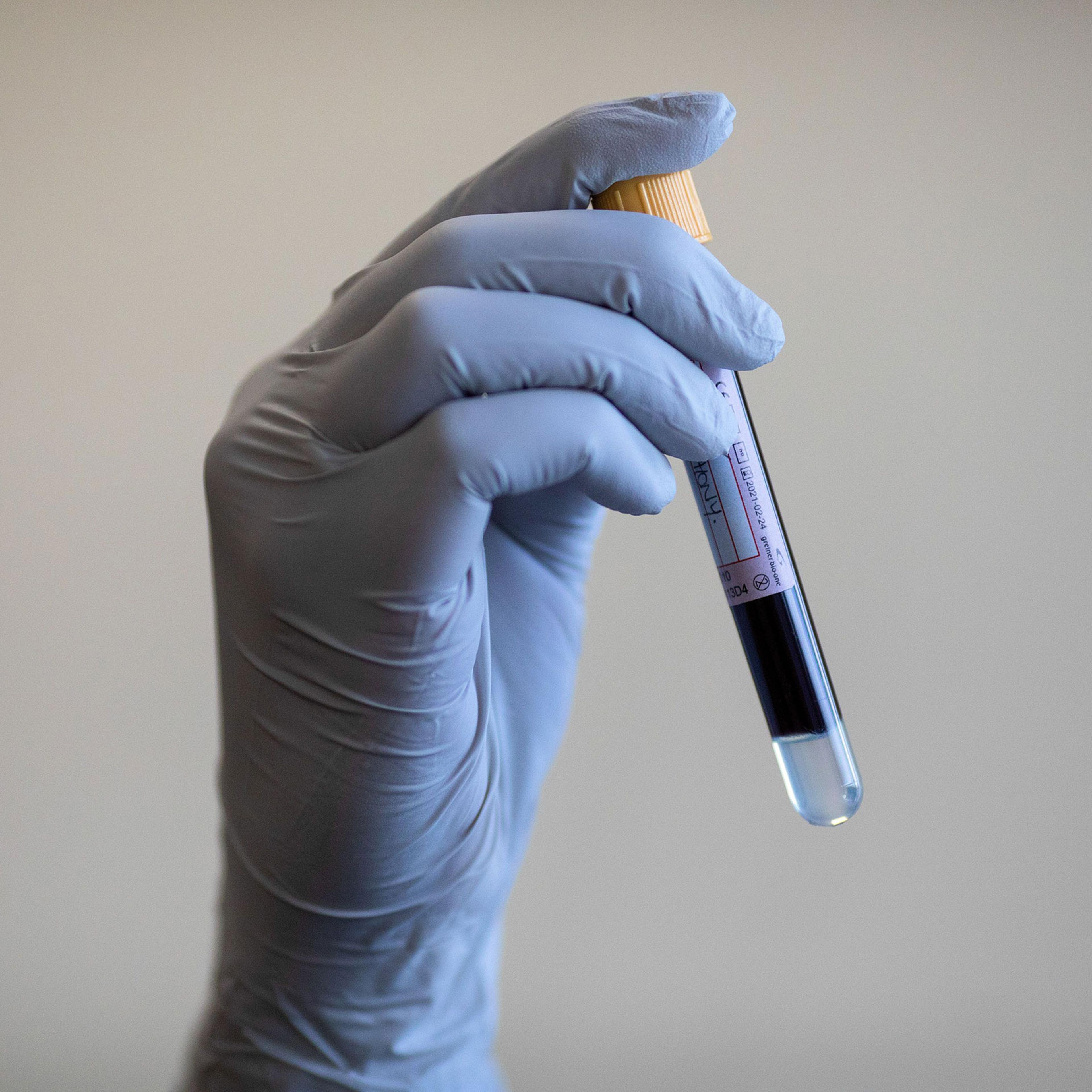 NHS Antibody Testing At West Midlands Ambulance Service, Birmingham, United Kingdom - 05 Jun 2020