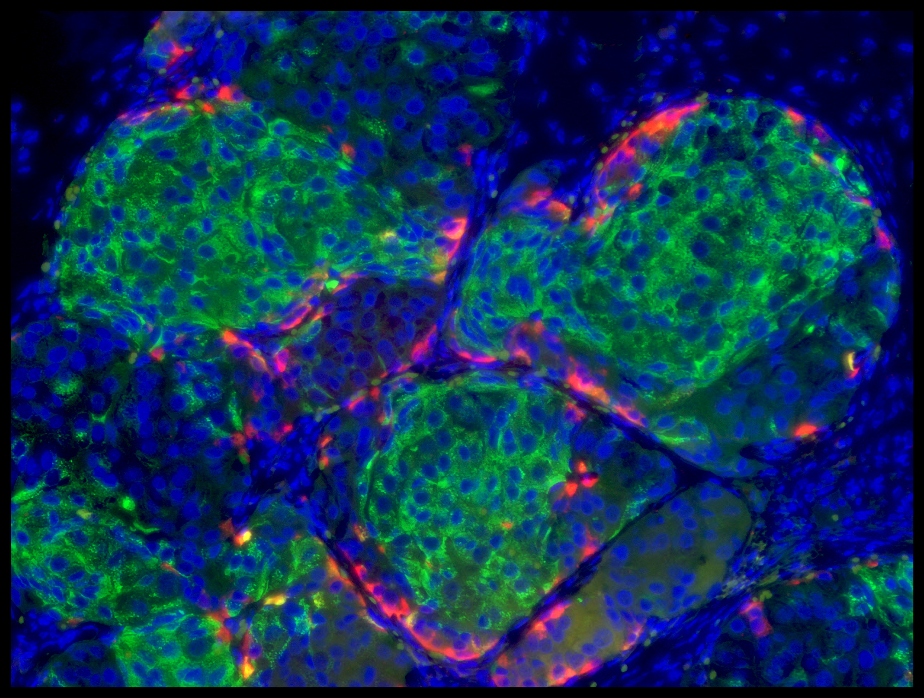 Human stem cell derived beta cells