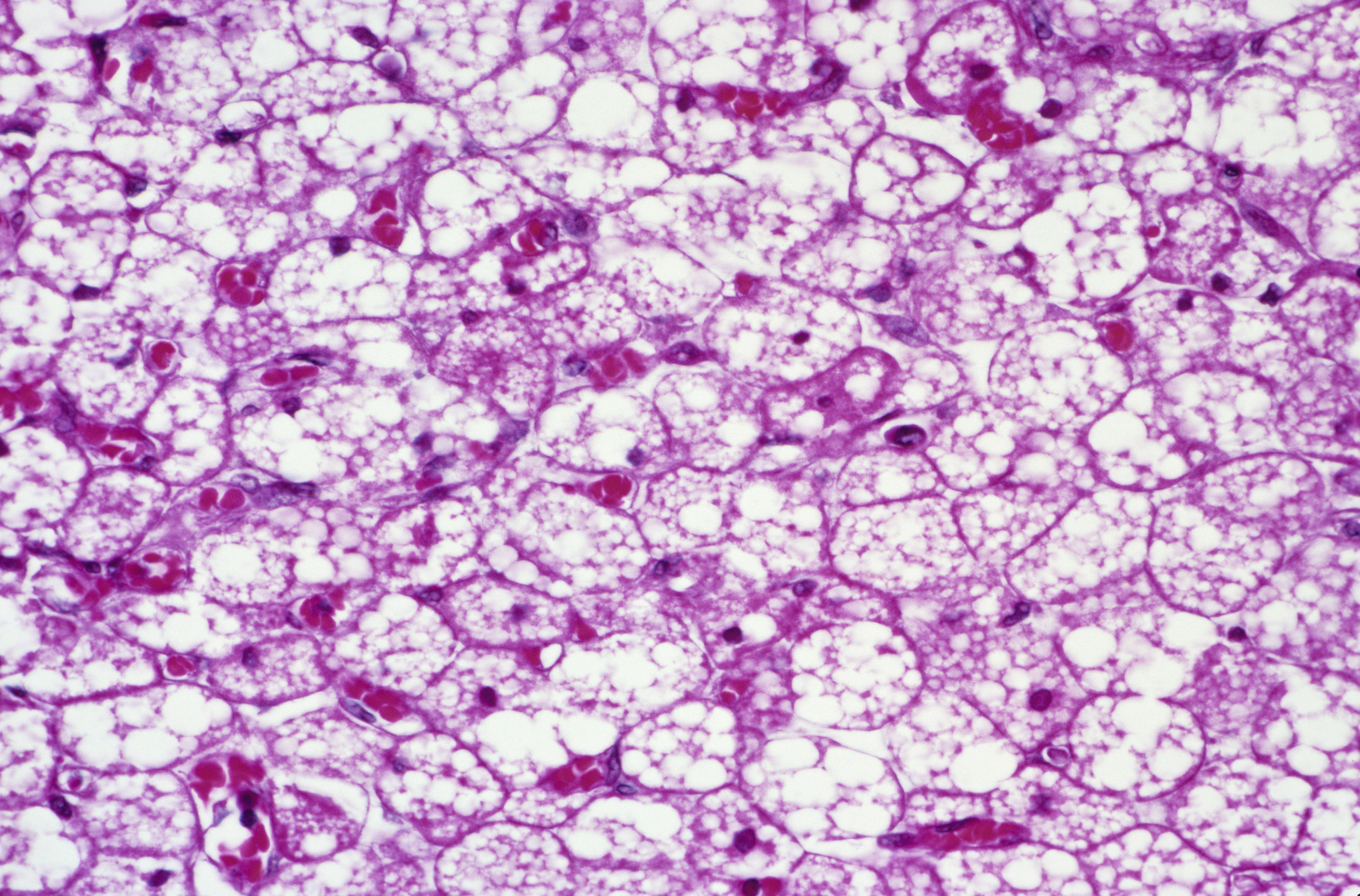 Brown tissue, also known as brown fat