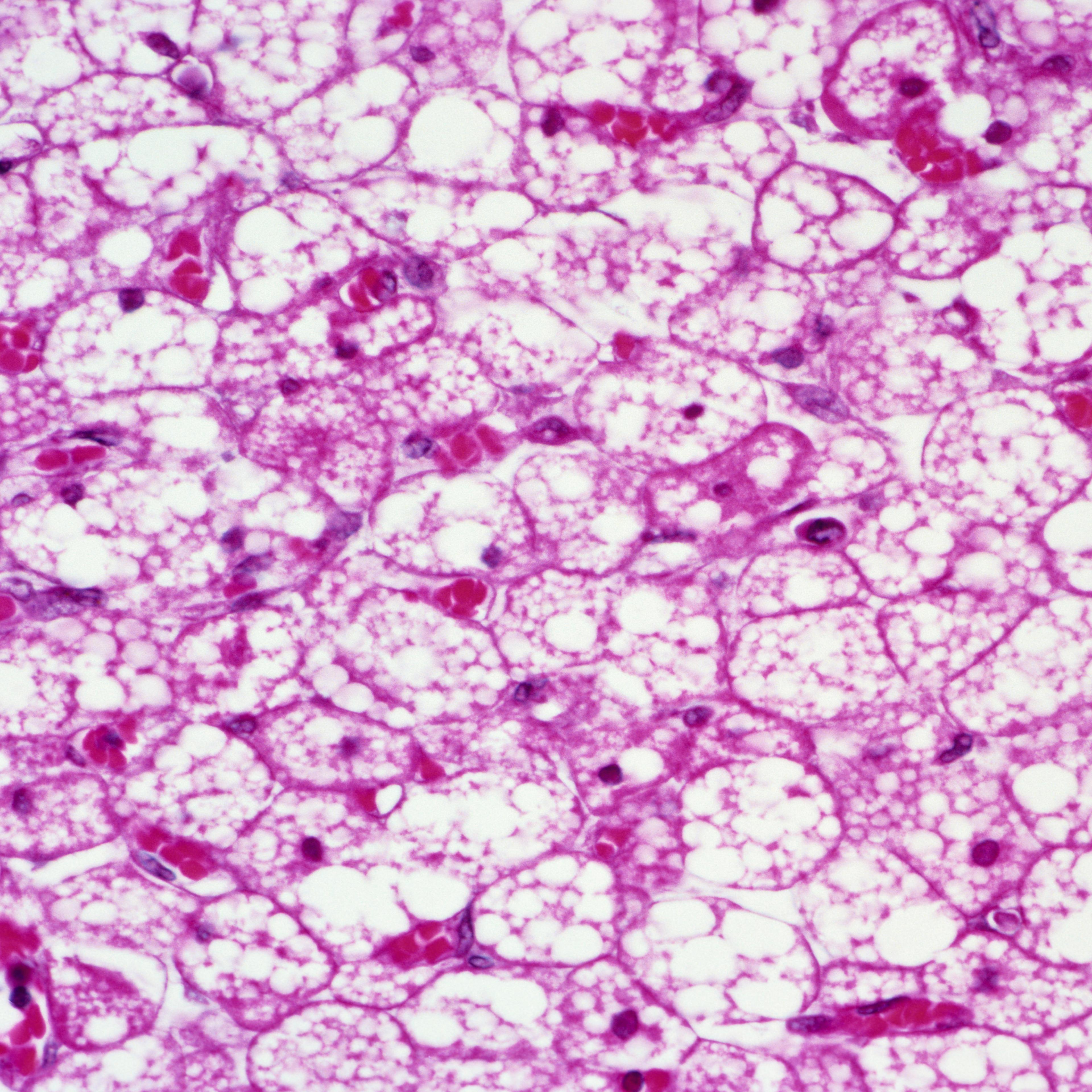 Brown tissue, also known as brown fat