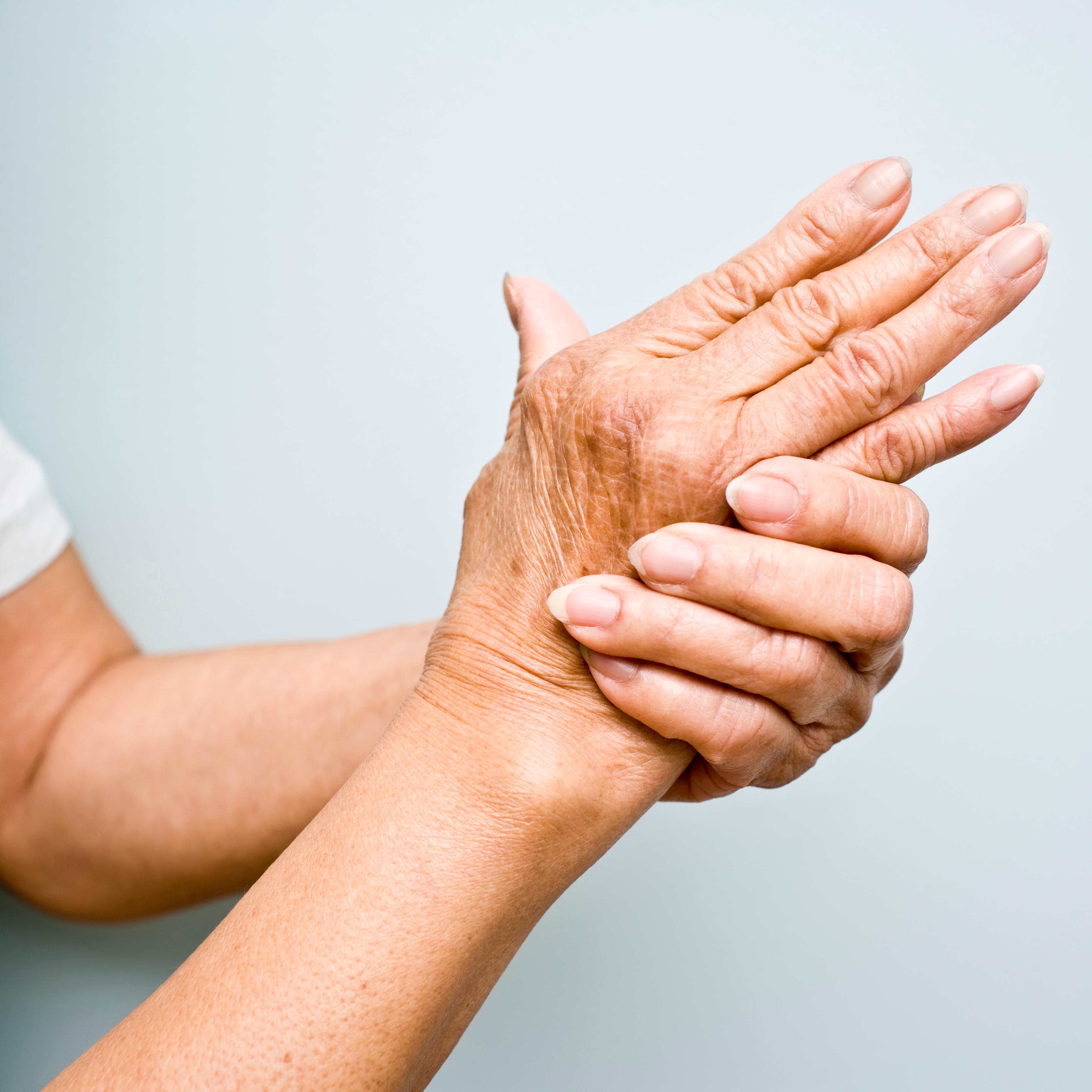 Elderly woman with Arthritis in her hands TIME health stock