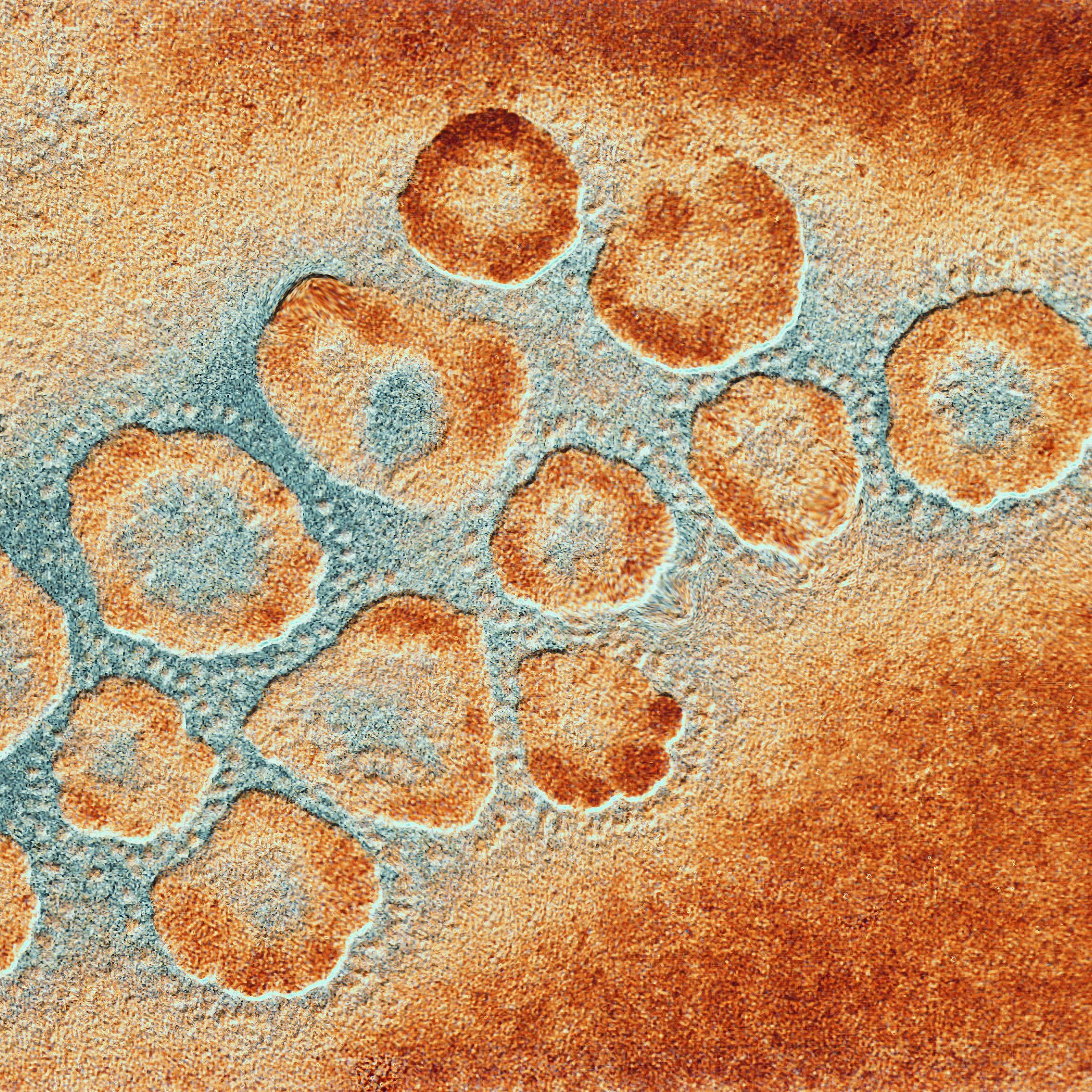 TEM of a cluster of corona viruses