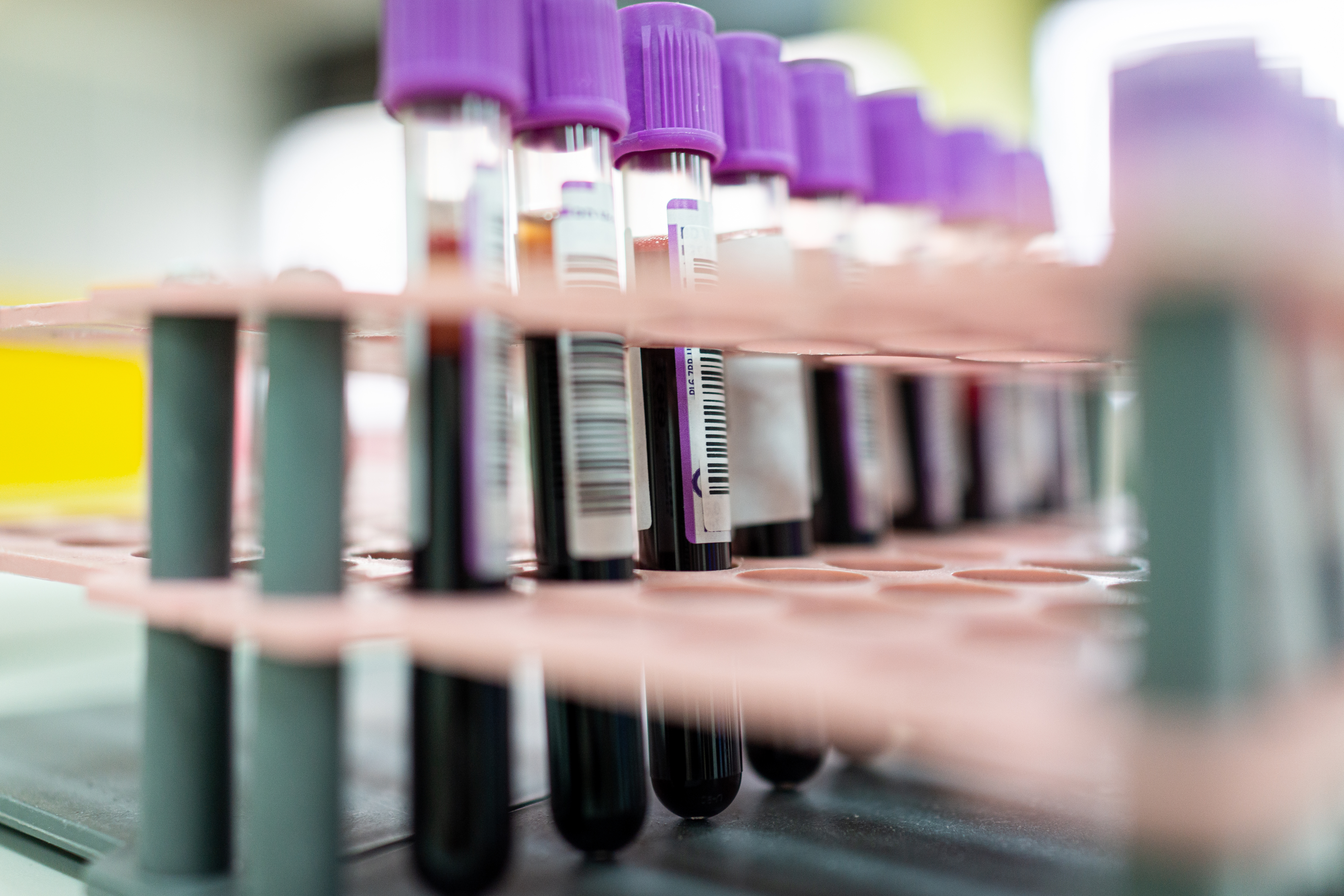 Laboratory result with blood tubes