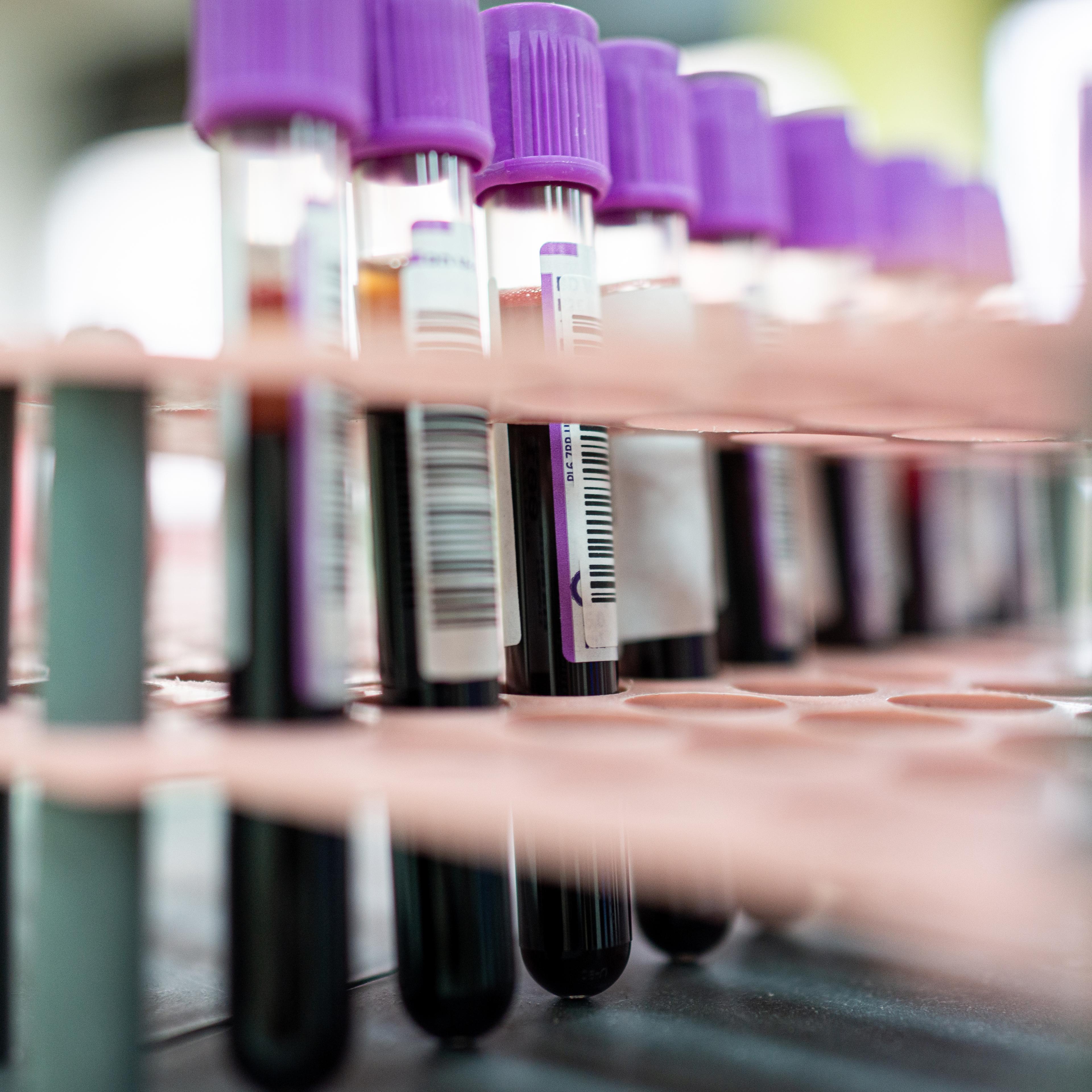 Laboratory result with blood tubes