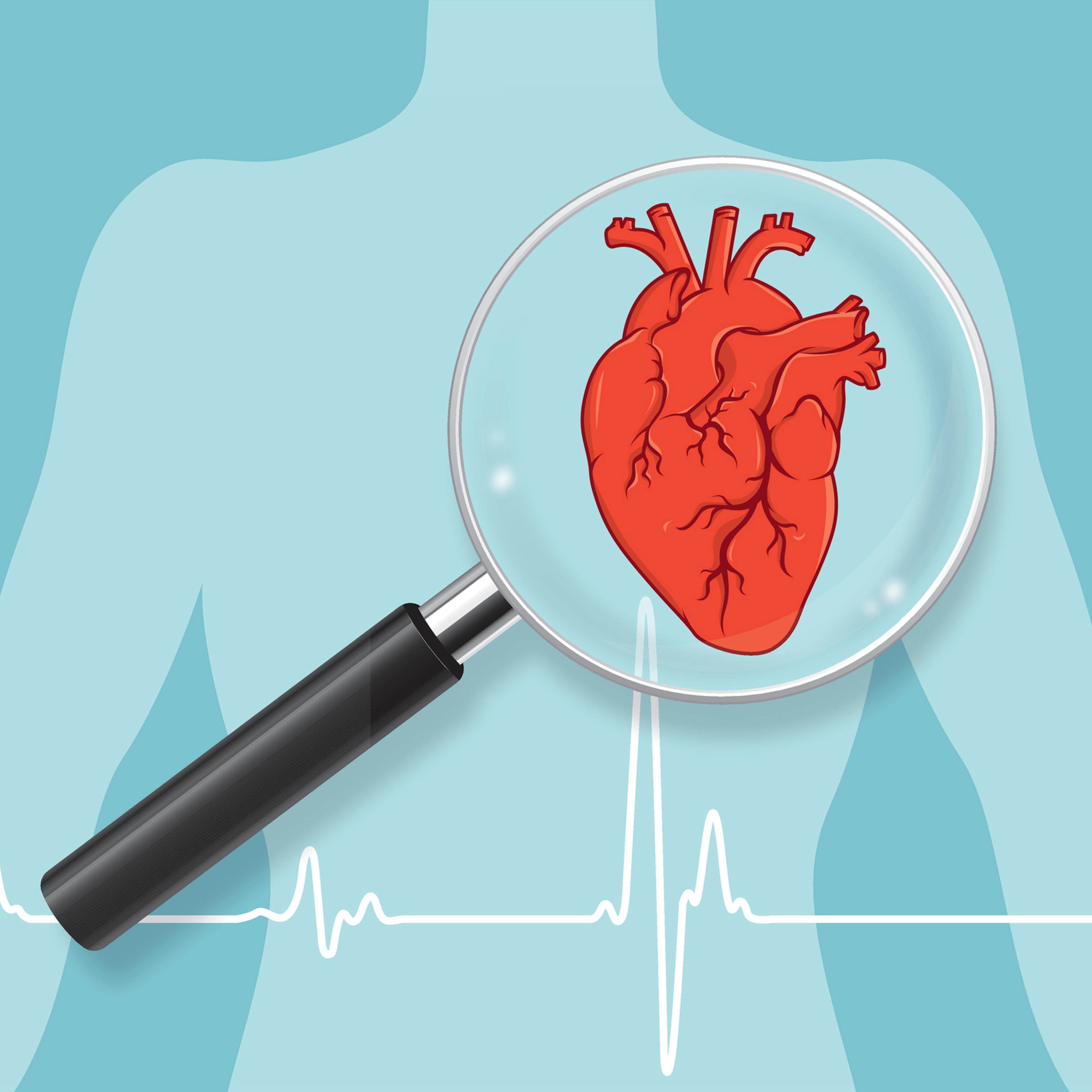 Heart checkup