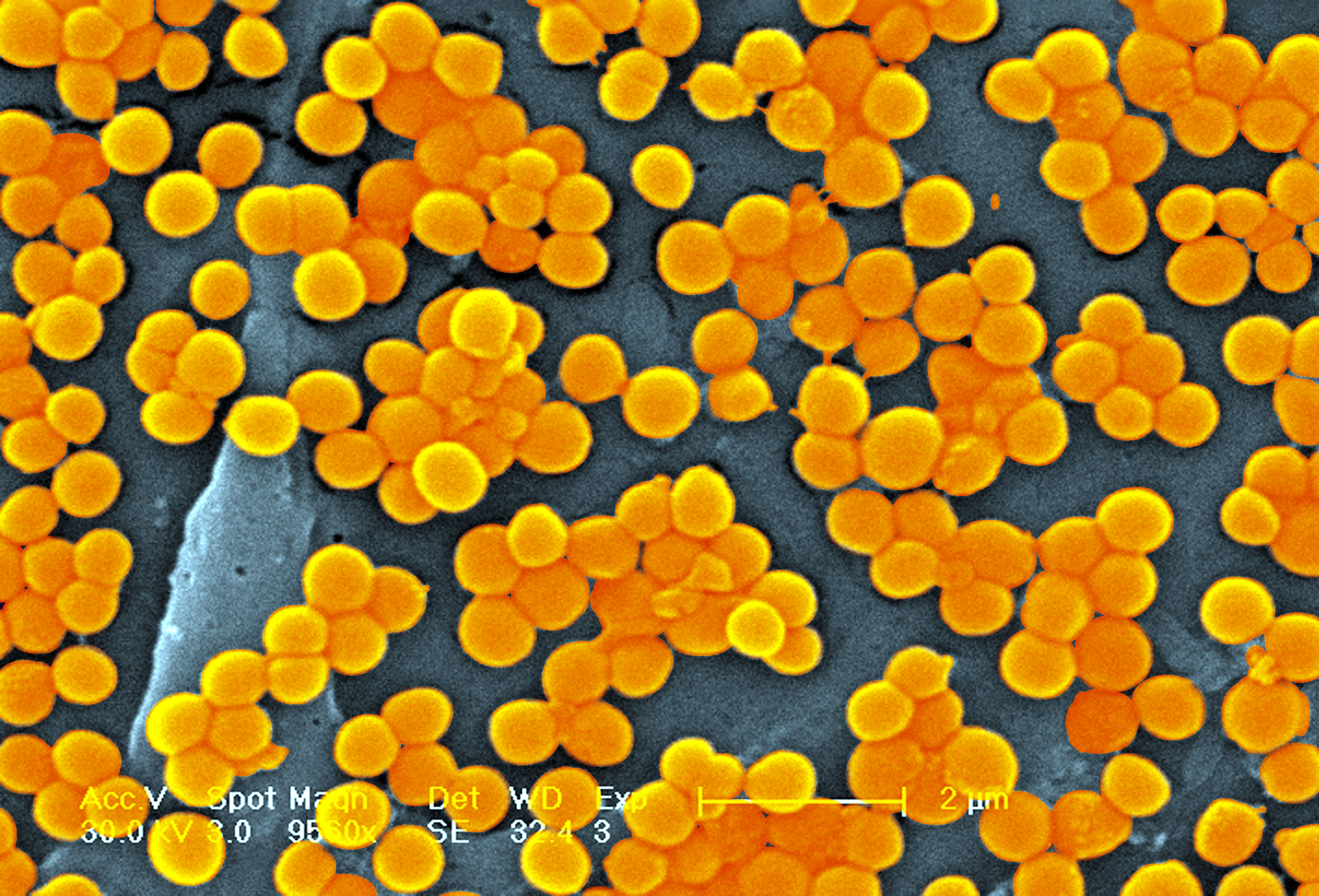 Staphylococcus Aureus Sem