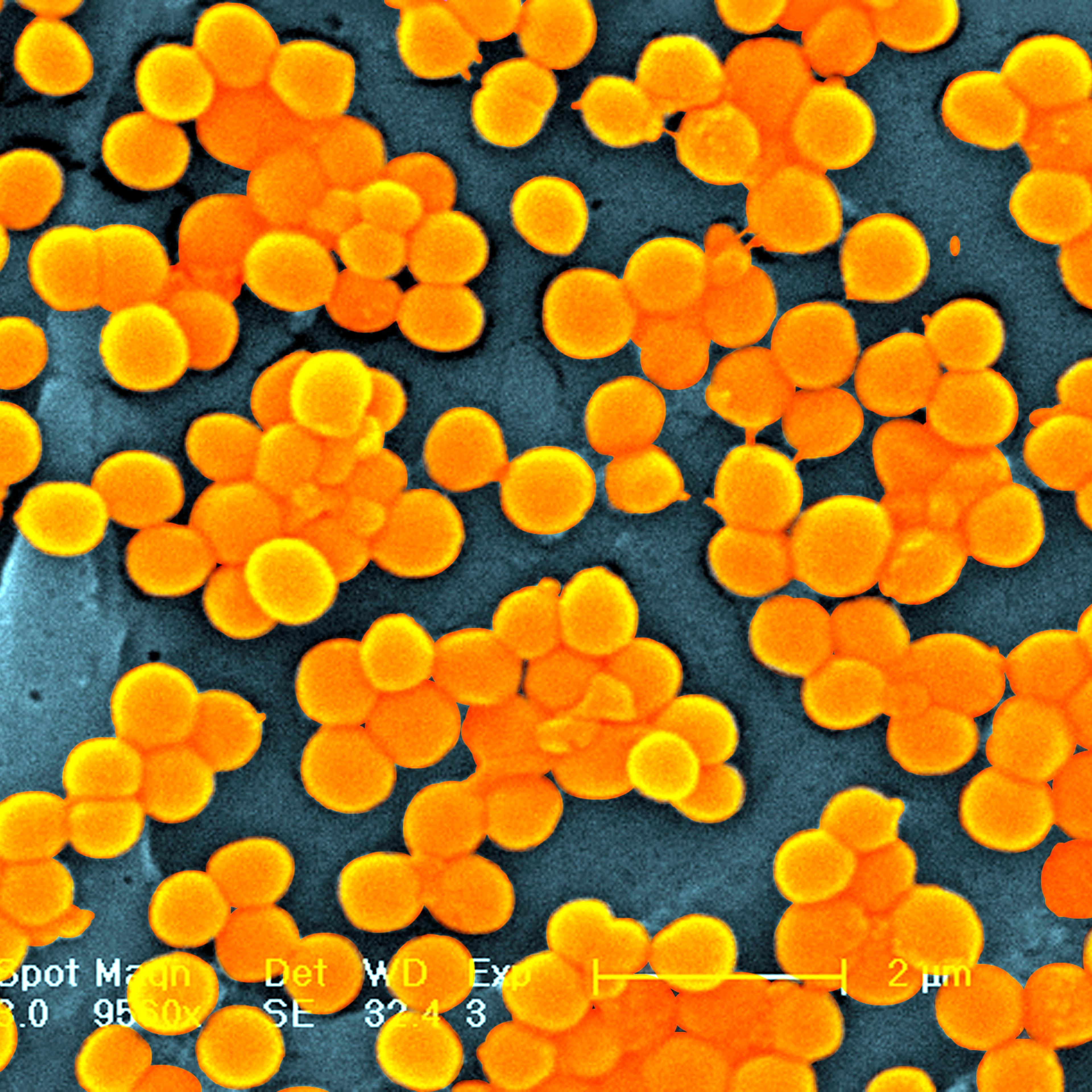 Staphylococcus Aureus Sem