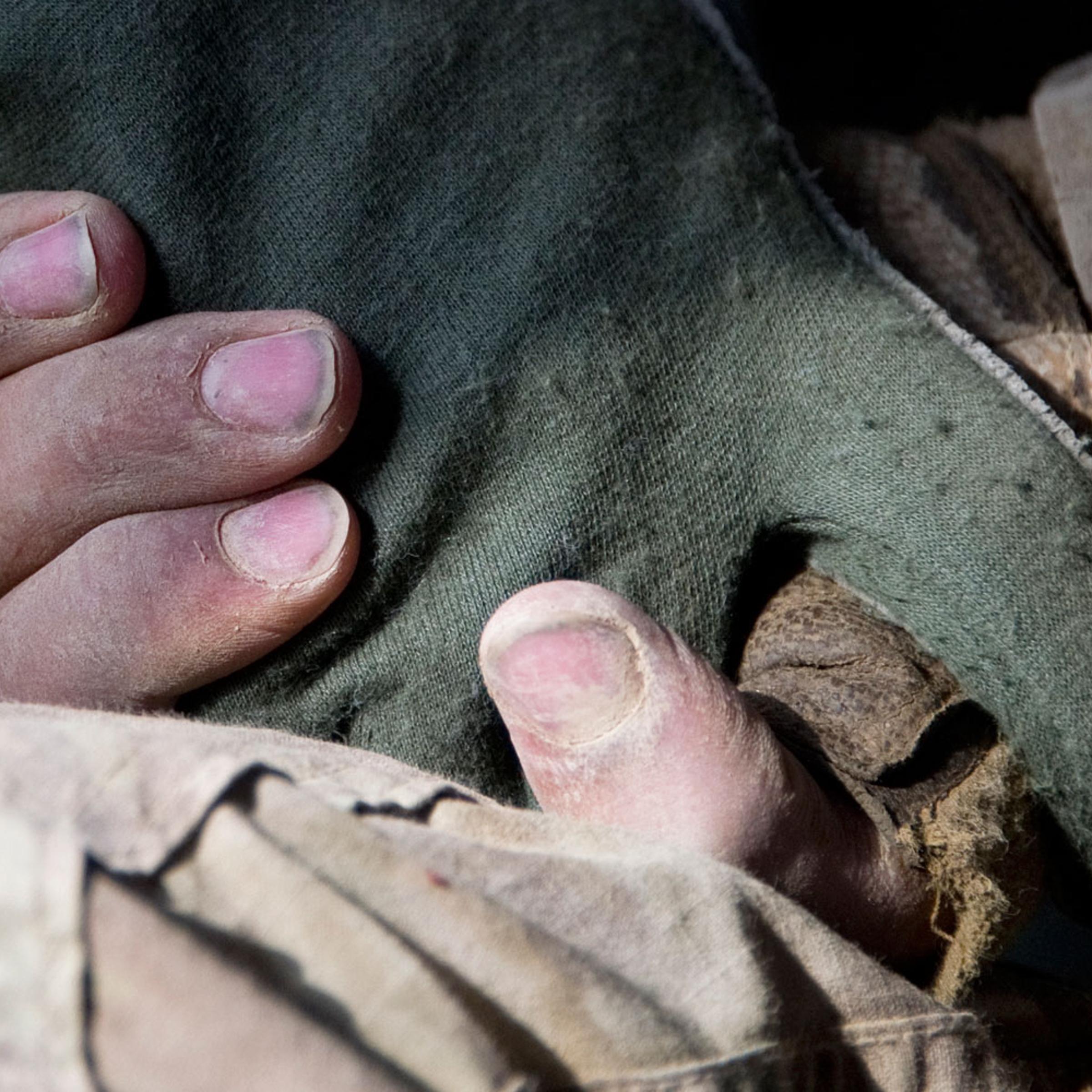A wounded U.S. soldier holds the hand of a flight-medic as he is airlifted by a medevac (medical evacuation) helicopter from the 159th Brigade Task Force Thunder to Kandahar Hospital Role 3, on August 23, 2011. Three soldiers were wounded while their vehicle was destroyed up by an Improvised Explosive Devise (IED).