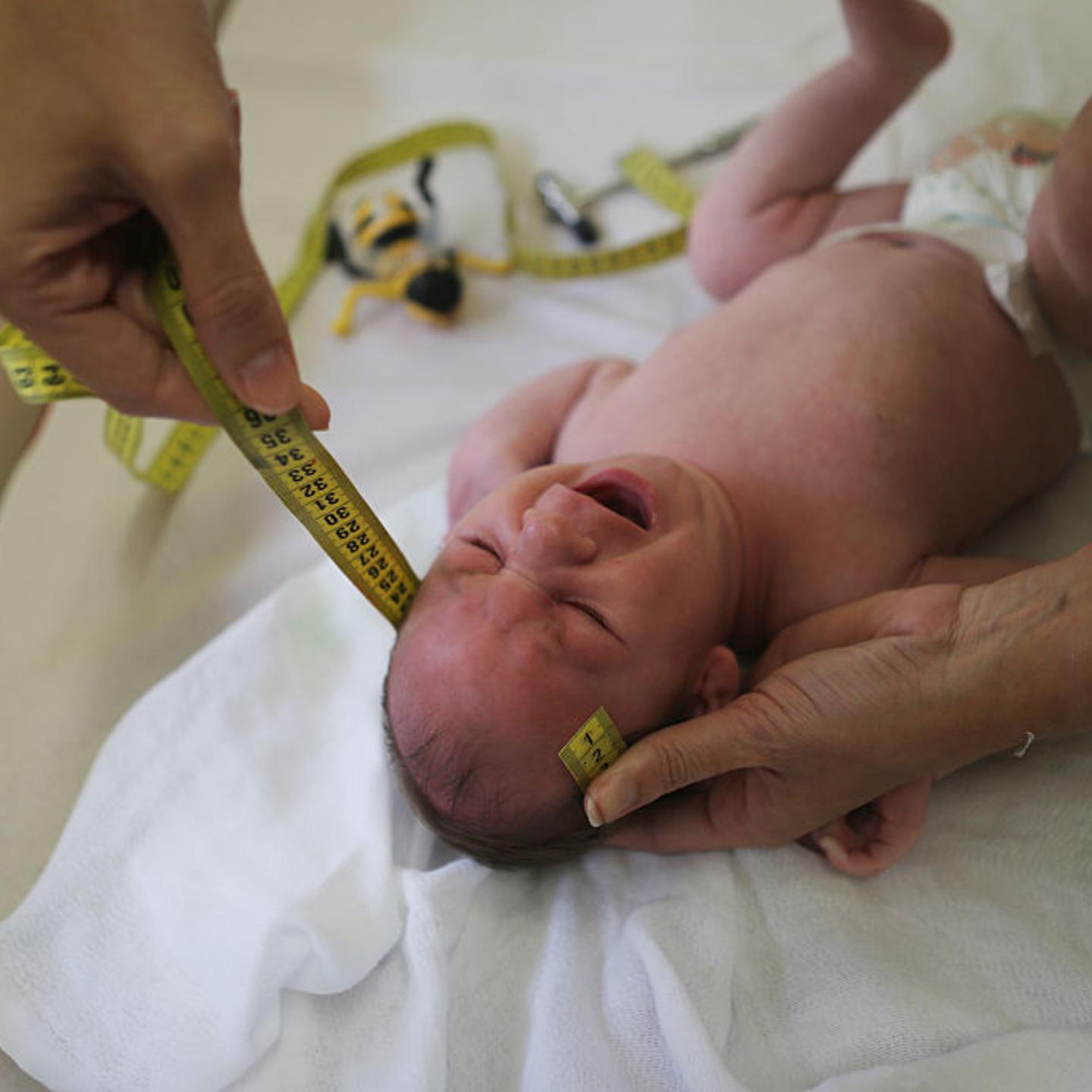 Dr. Vanessa Van Der Linden, the neuro-pediatrician who first recognized and alerted authorities over the microcephaly crisis in Brazil, measures the head of a 2-month-old baby with microcephaly on Jan. 27, 2016 in Recife, Brazil.