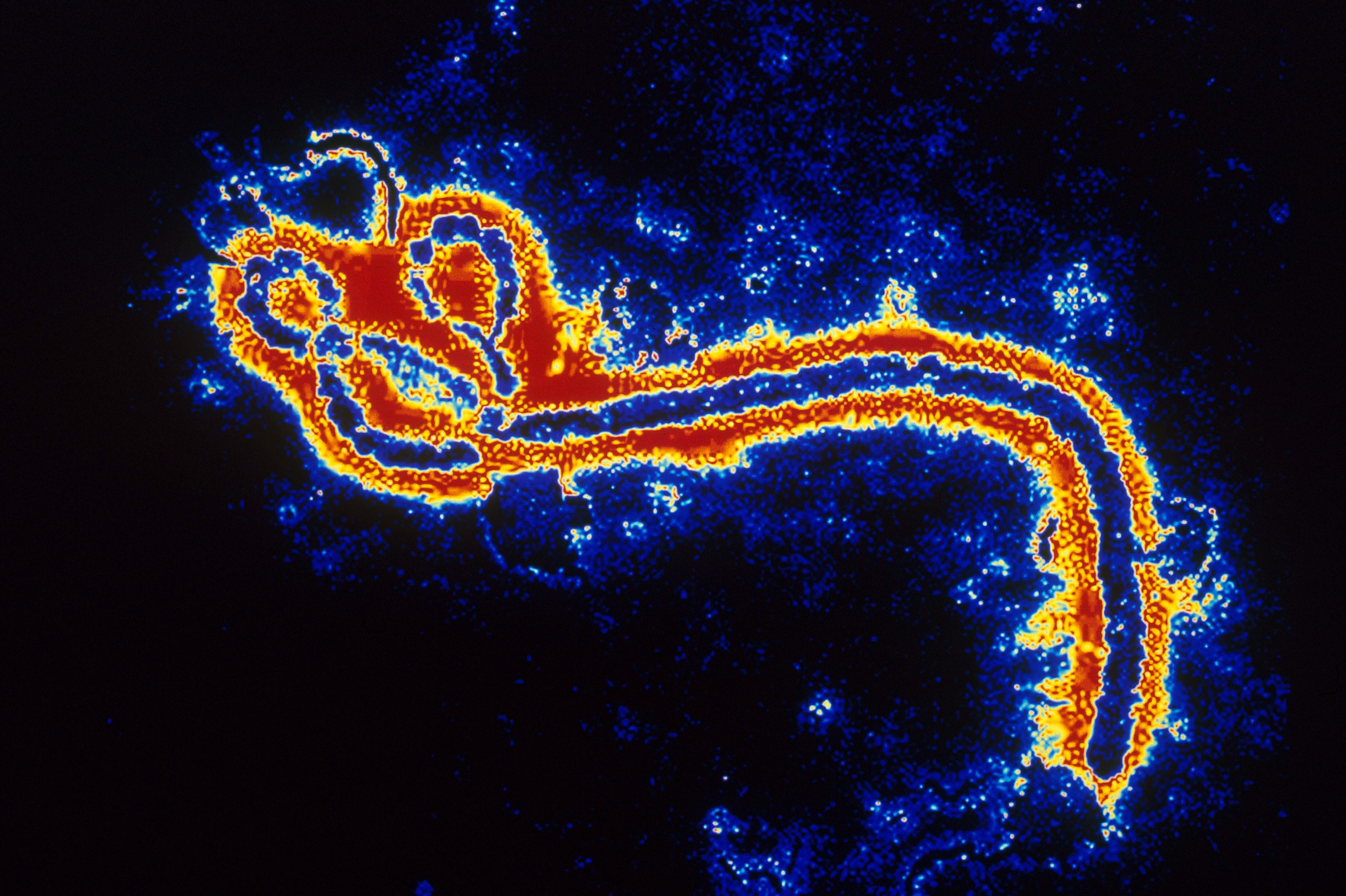ebola