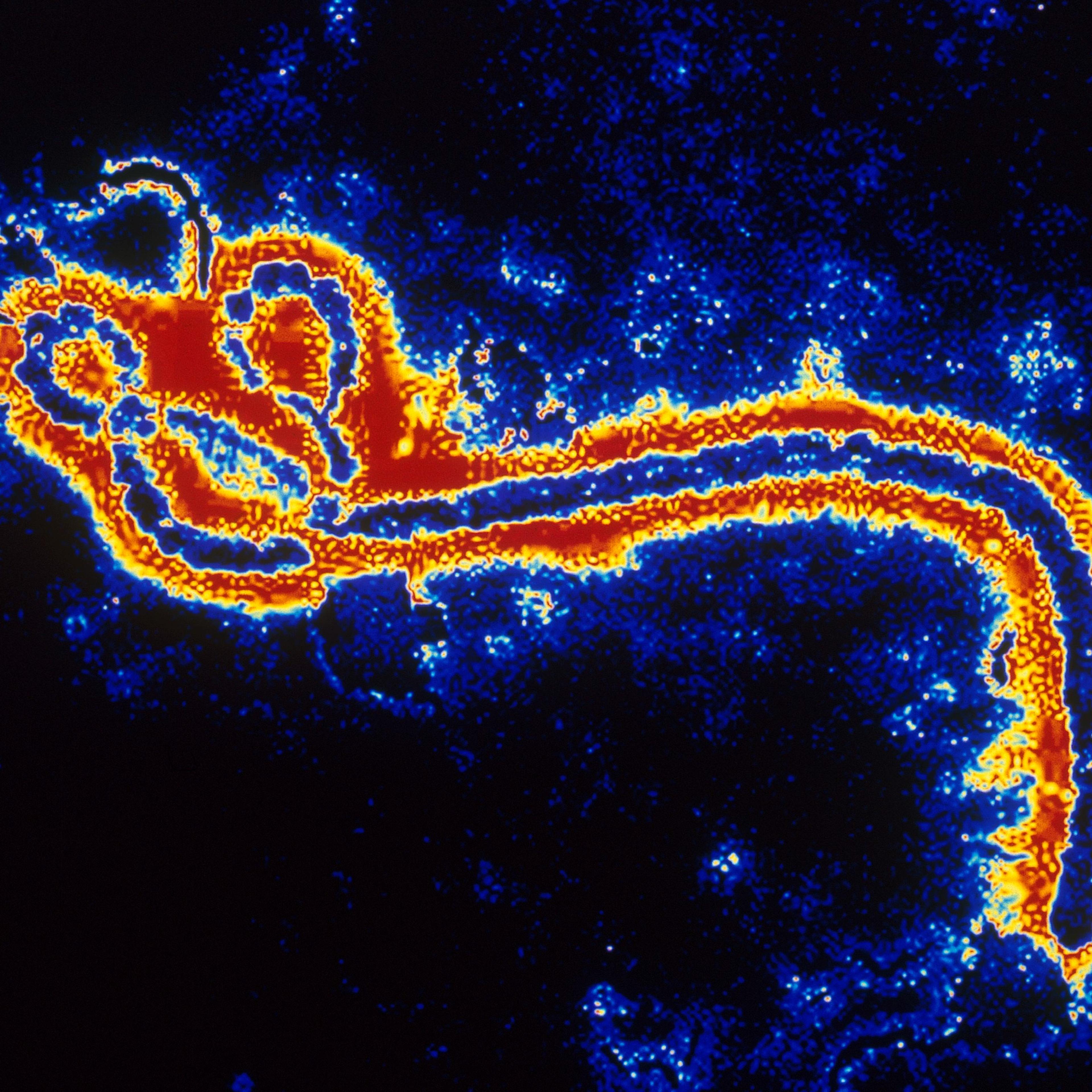 ebola