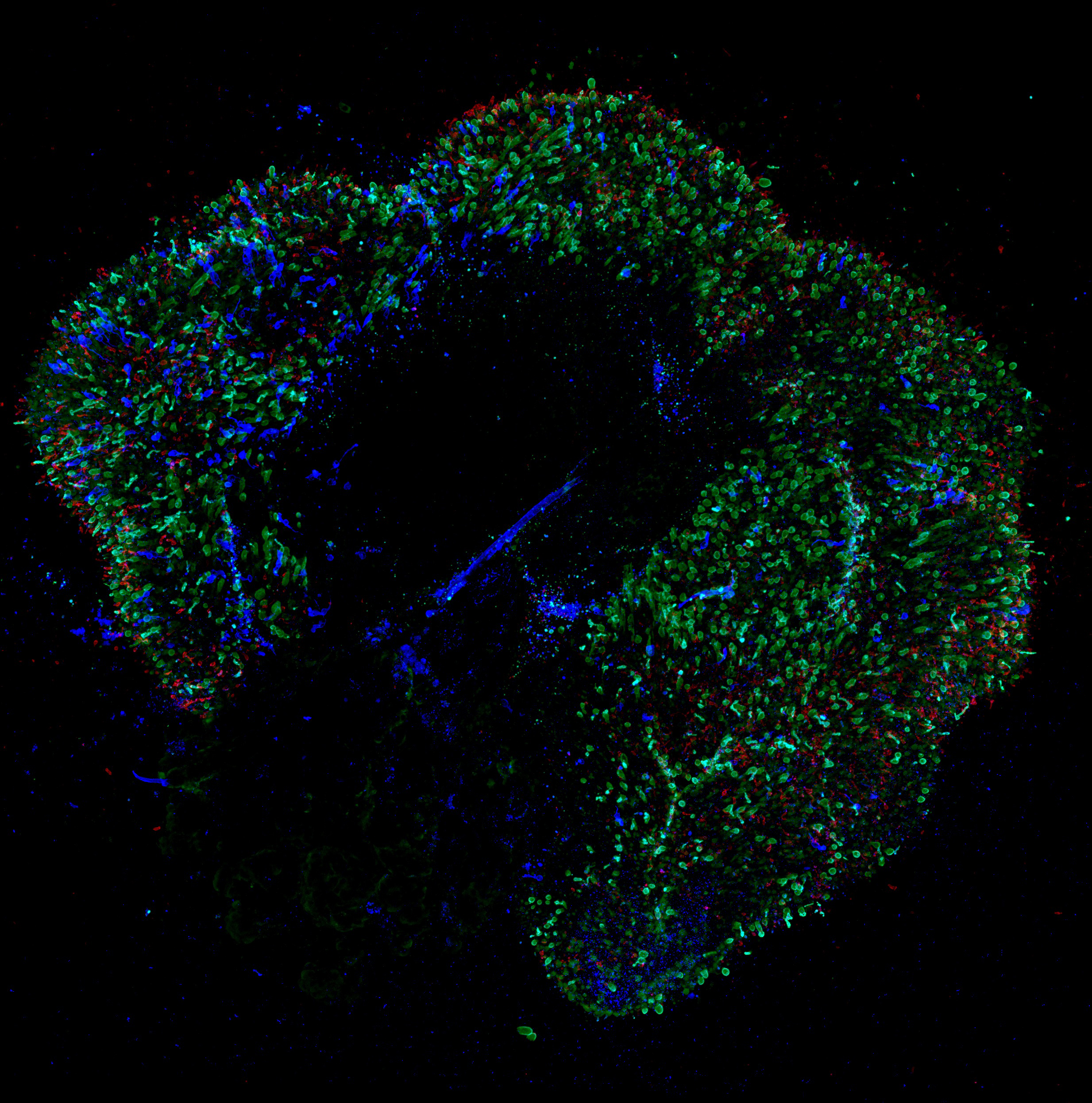 human-retina