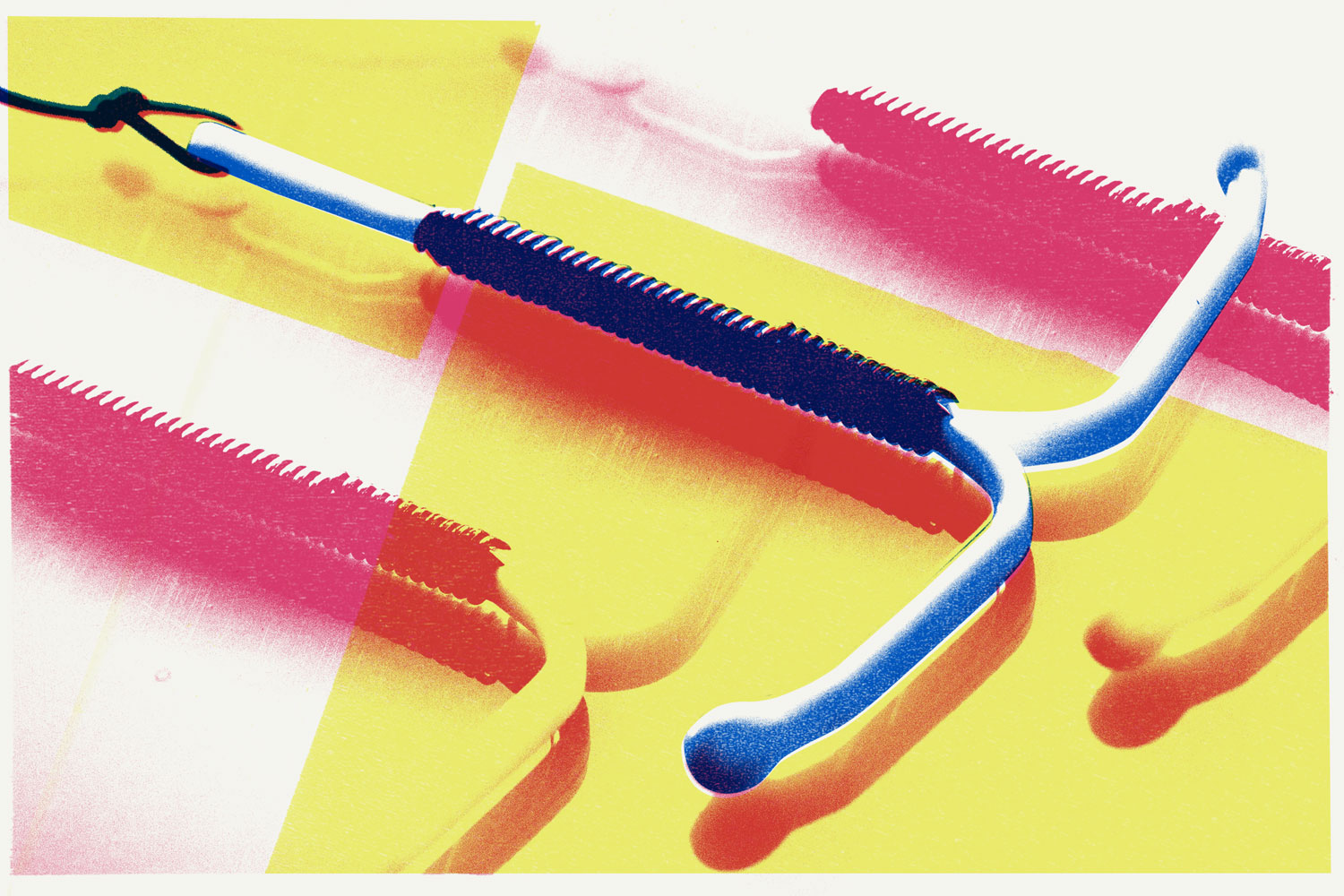 IUDs