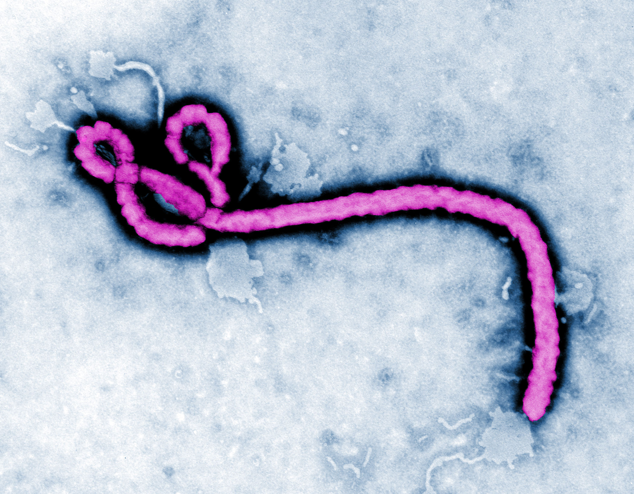 Ebola virus