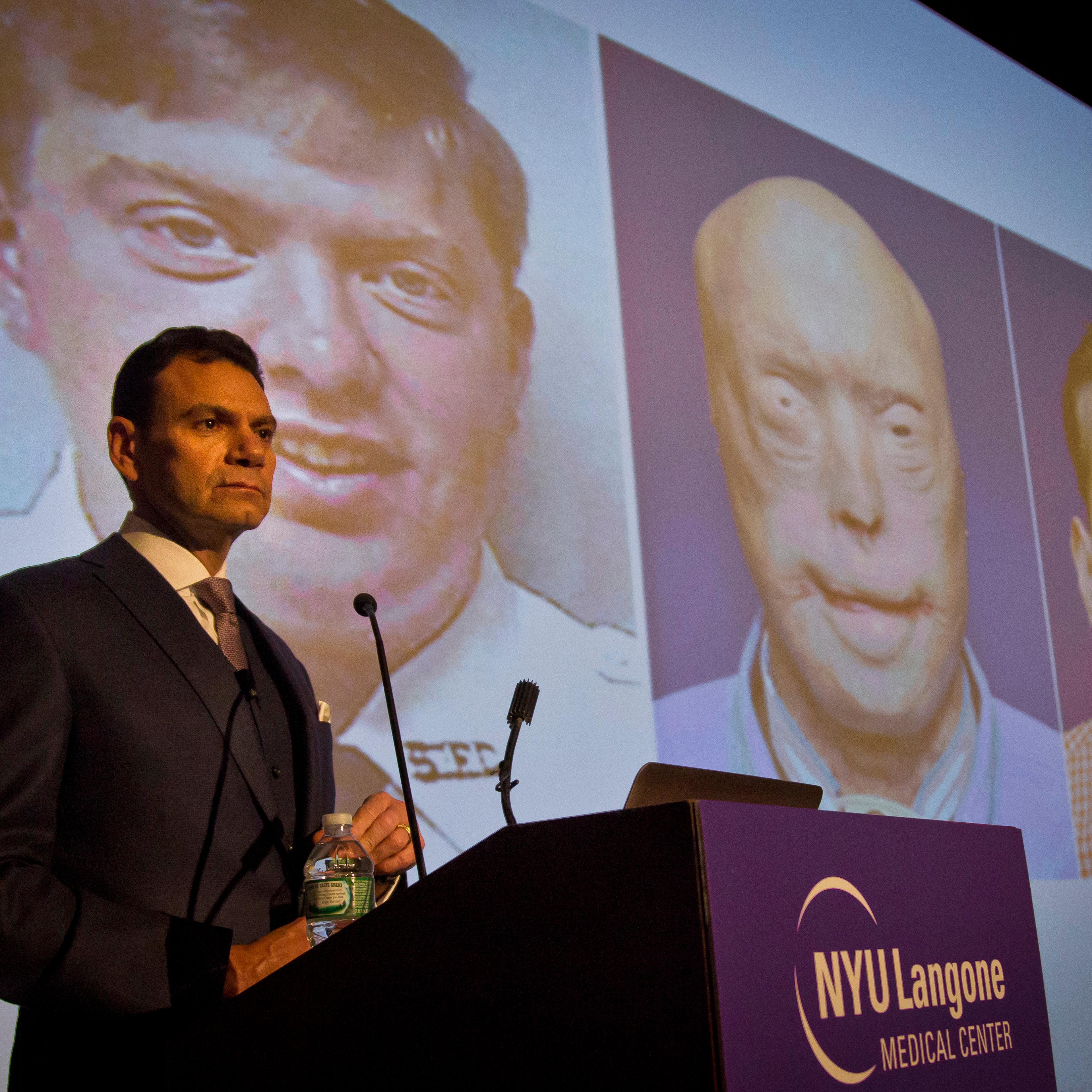 Dr. Eduardo Rodriguez, who led the surgical team that did the face transplant on Patrick Hardison, a volunteer firefighter who was badly burned in a 2001 blaze, speaks during a news conference as he shows before-and-after images of Hardison in New York o