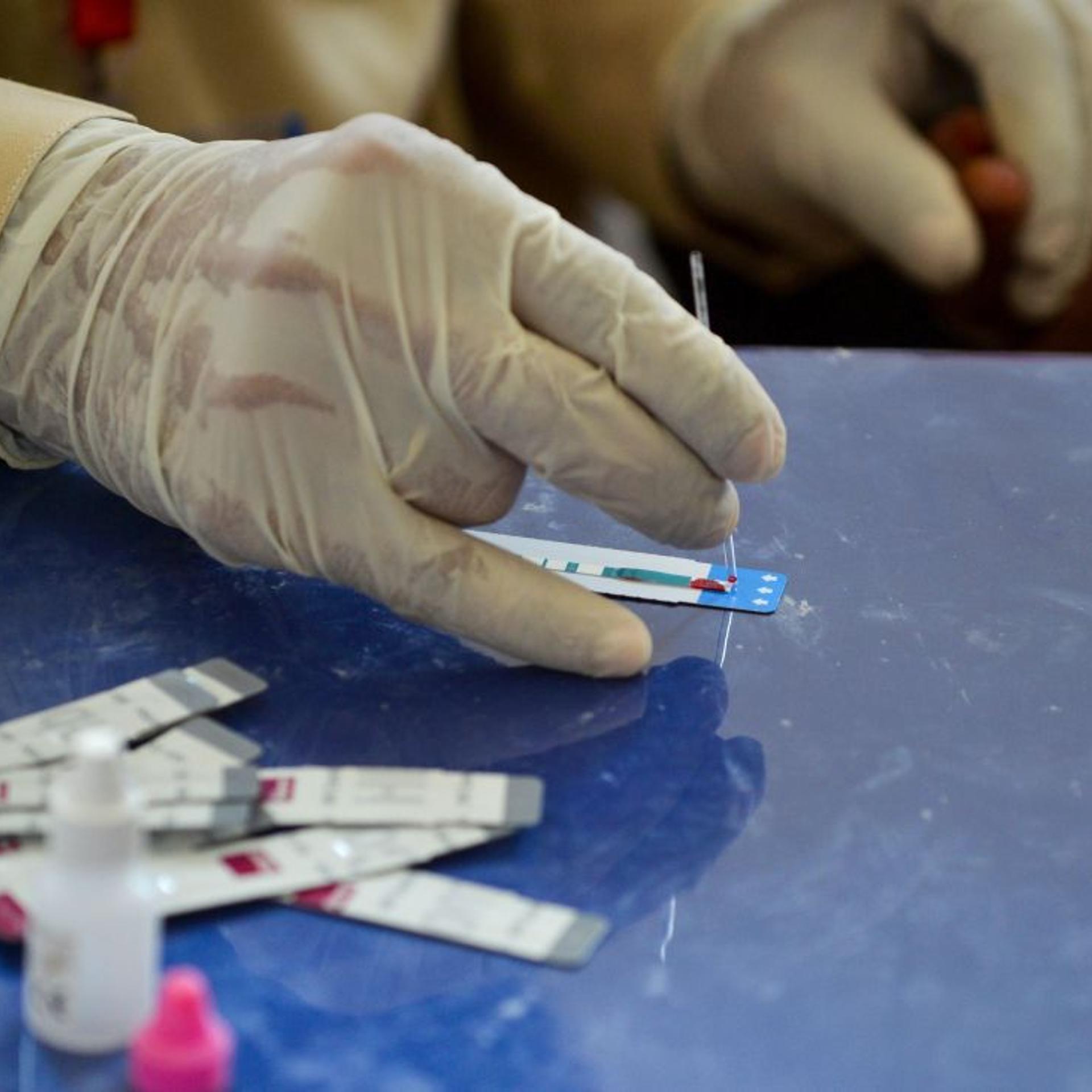 Larkana, Pakistan HIV outbreak