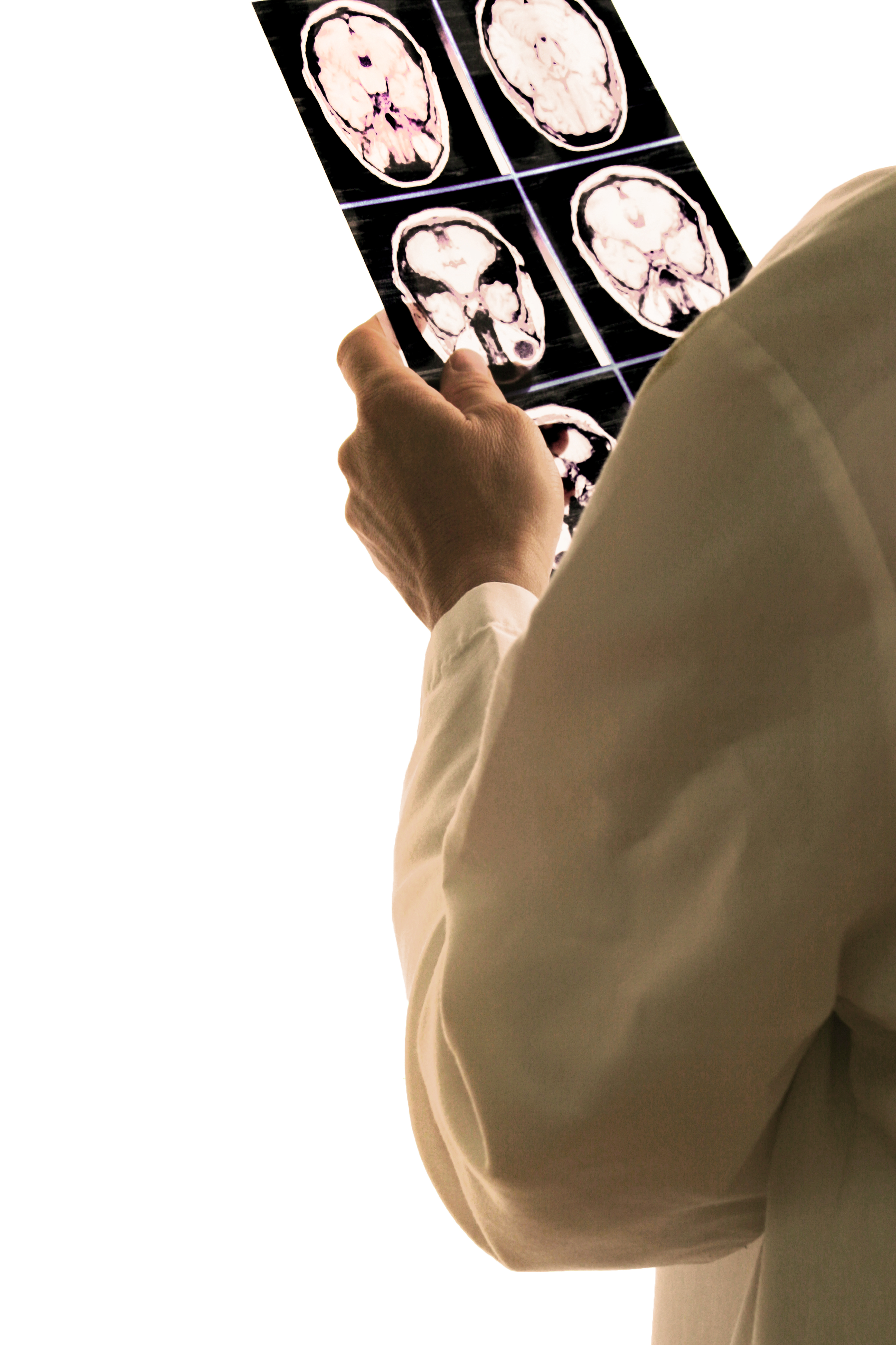 medical scans