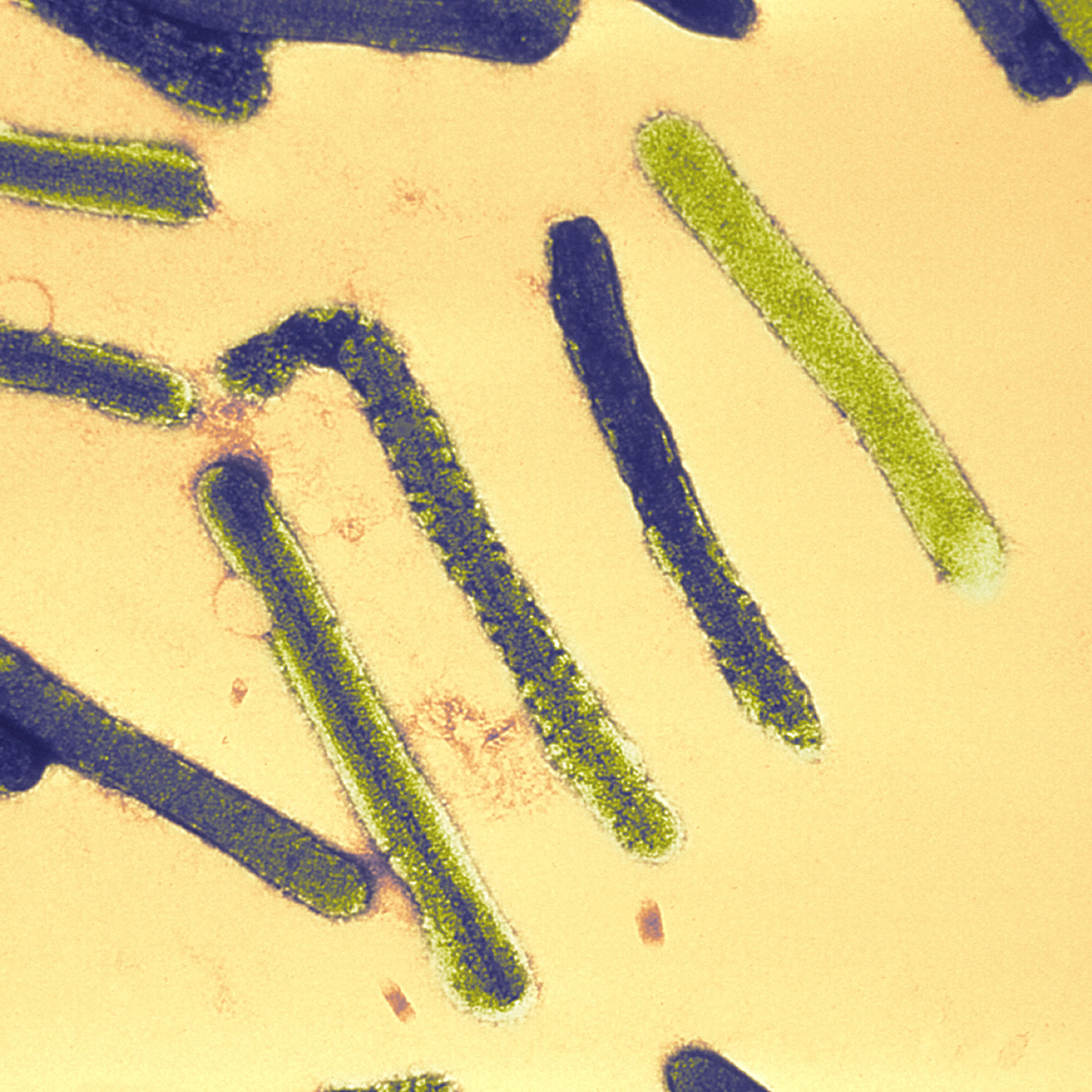 Marburg Virus