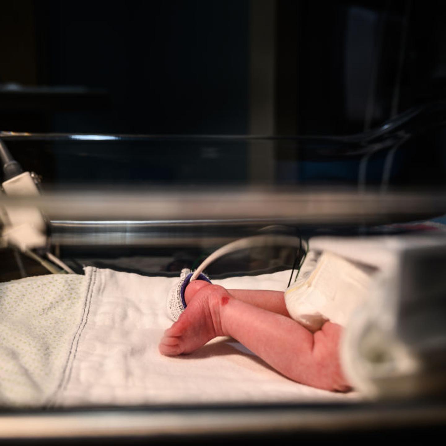Opioid withdrawal baby