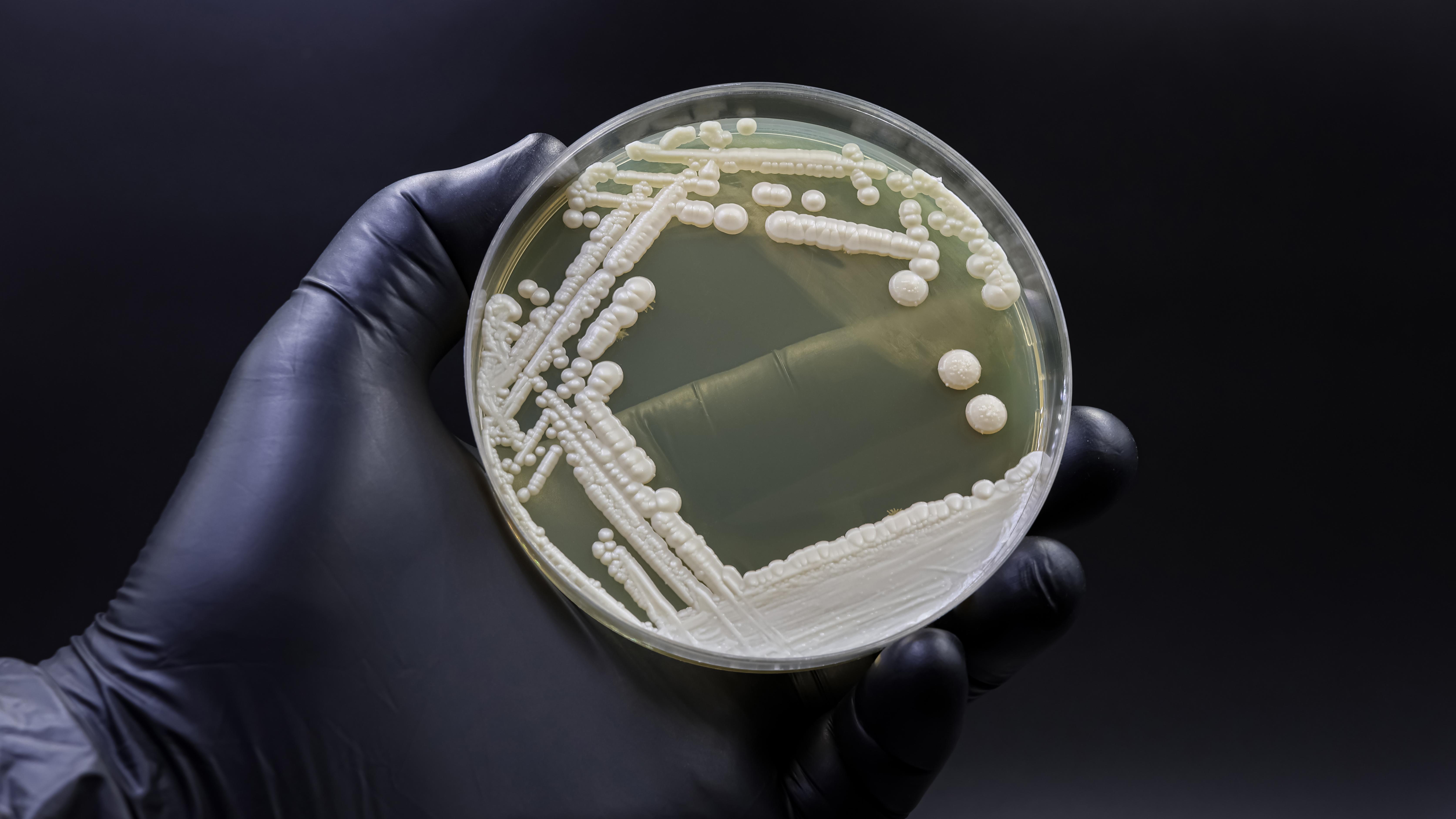 Why Dangerous Fungi Are on the Rise