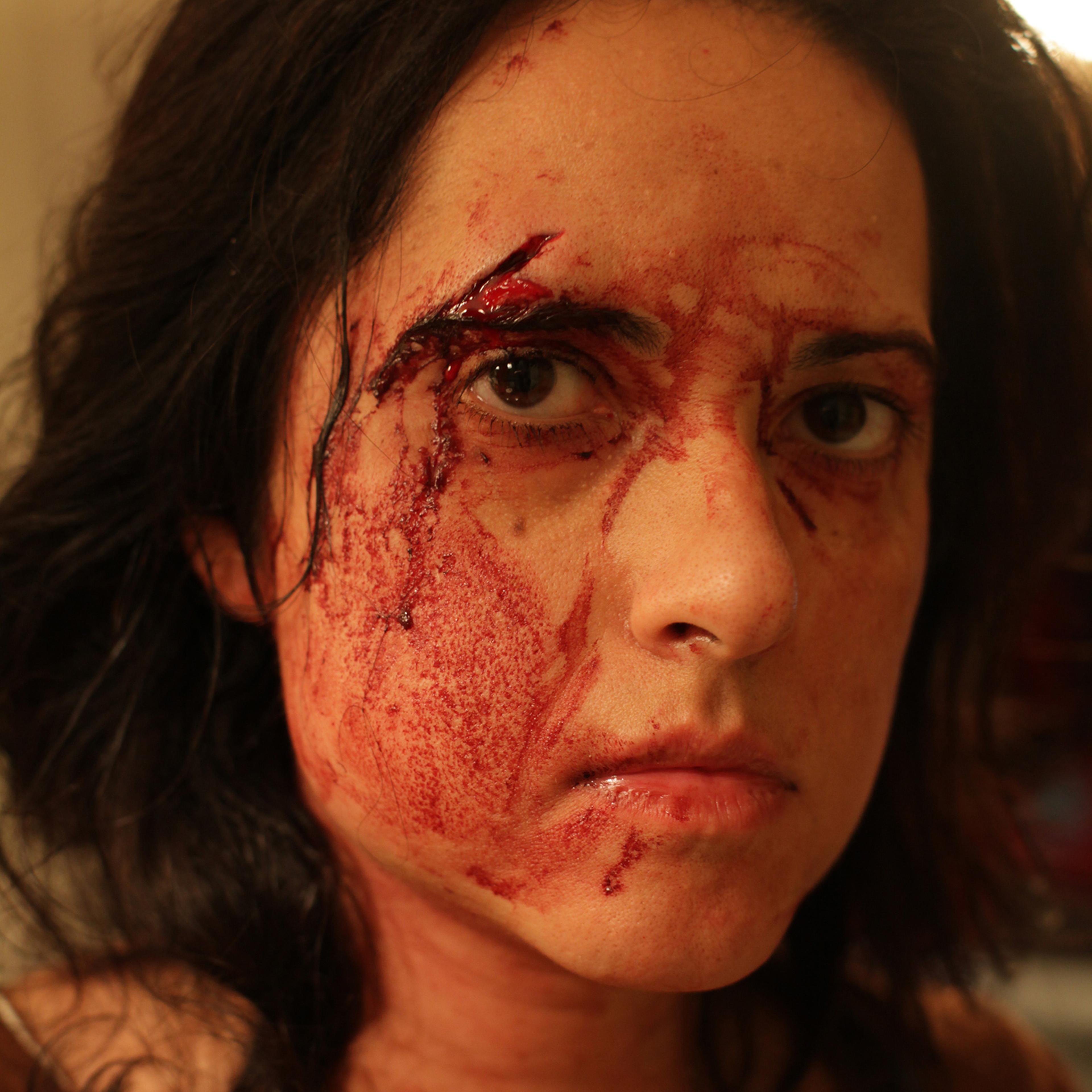 A self portrait by photojournalist Rena Effendi taken after an attack