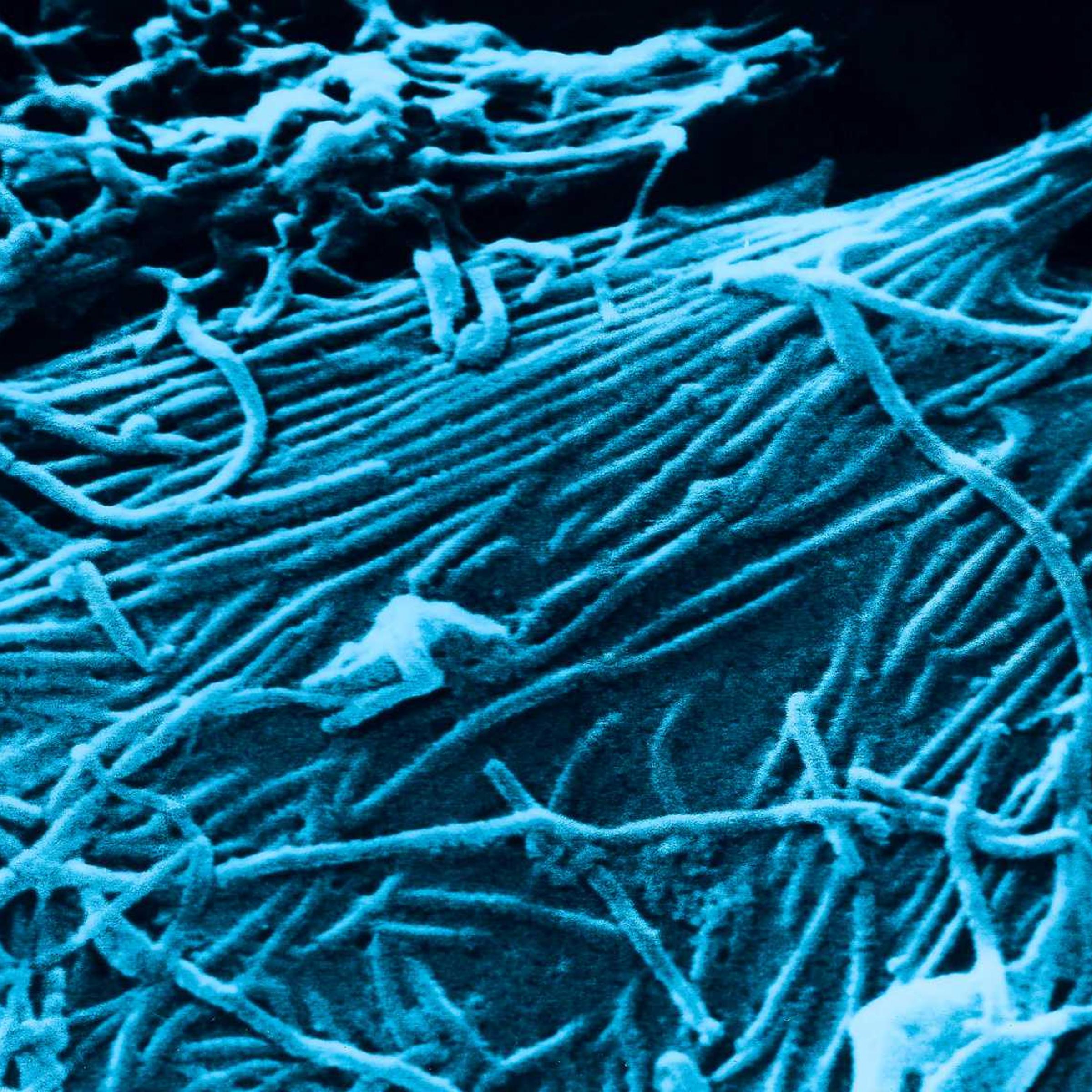 This scanning electron micrograph, SEM, depicts a number of Ebola virions.