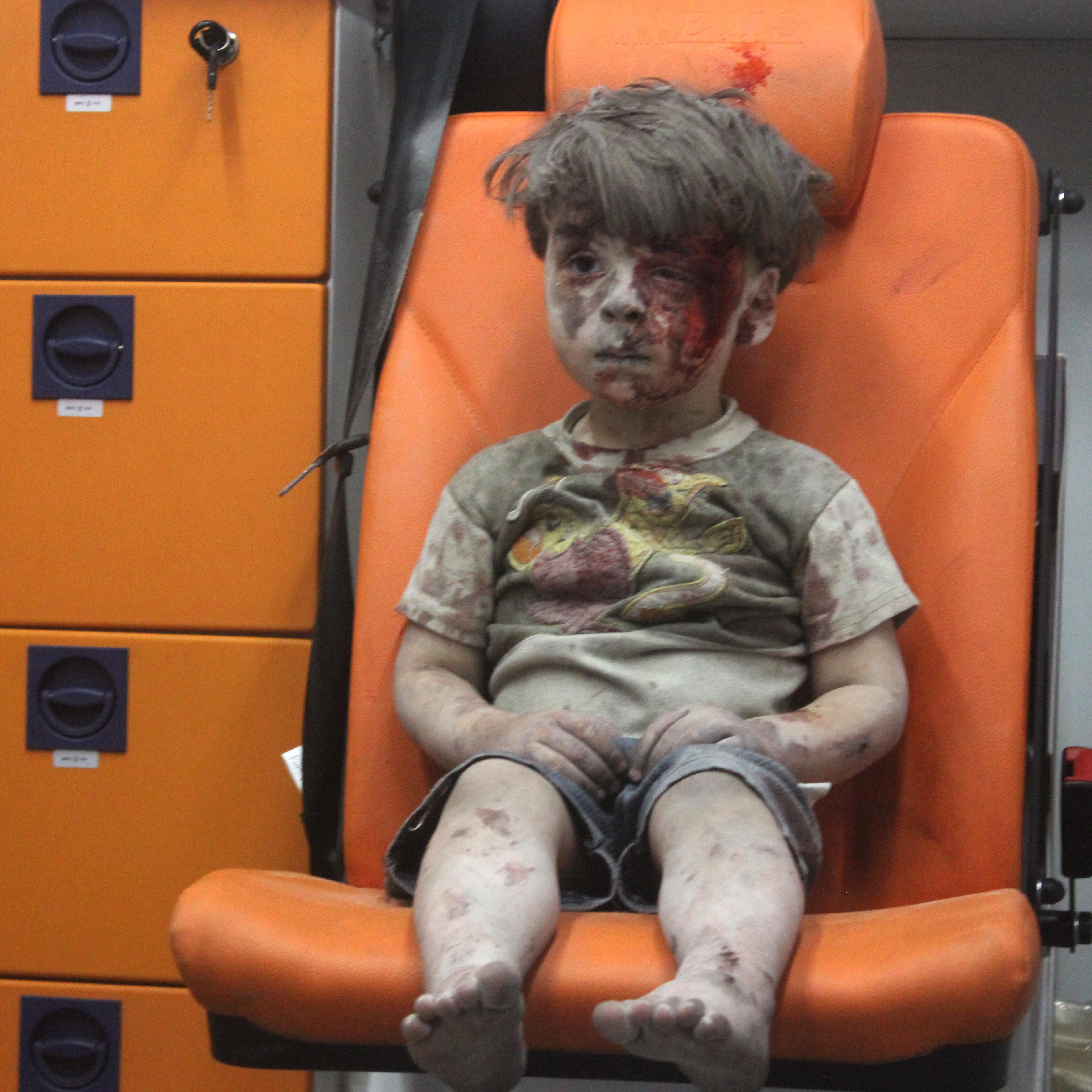 5-year-old wounded Syrian kid Omran Daqneesh sits alone in the back of the ambulance after he got injured during Russian or Assad regime forces air strike targeting the Qaterji neighbourhood of Aleppo on August 17, 2016.