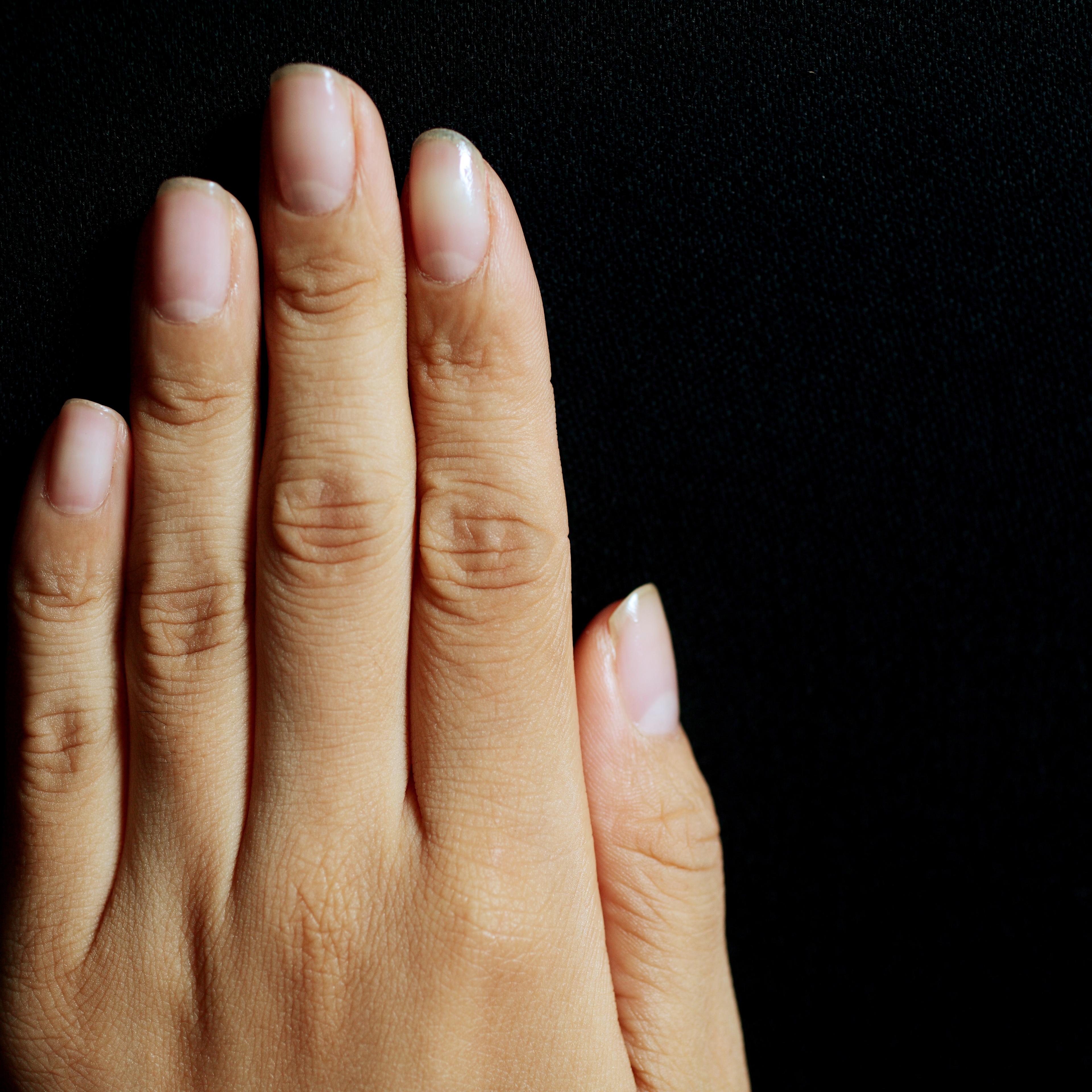 fingernails