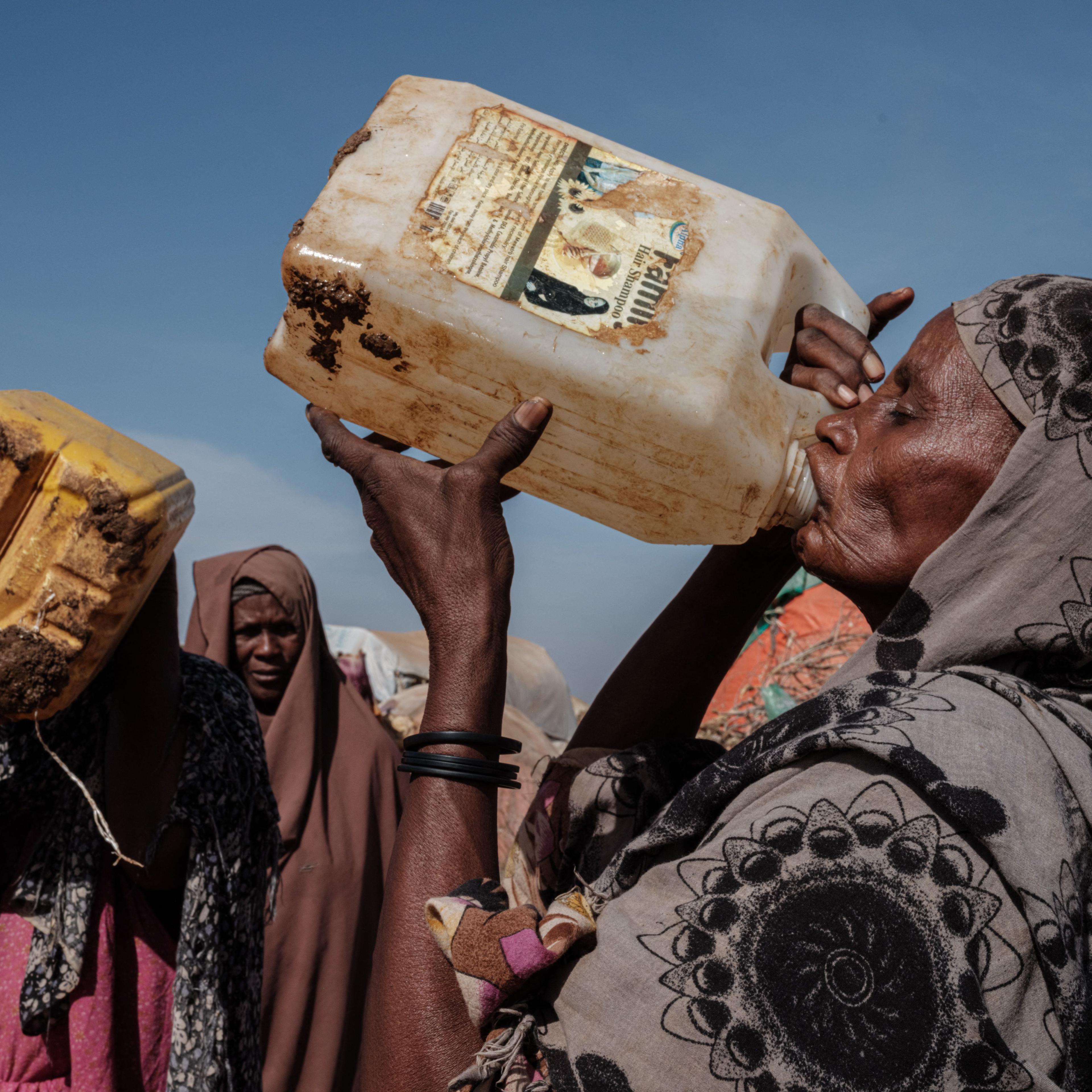 TOPSHOT-SOMALIA-DISPLACED-DROUGHT-FAMINE