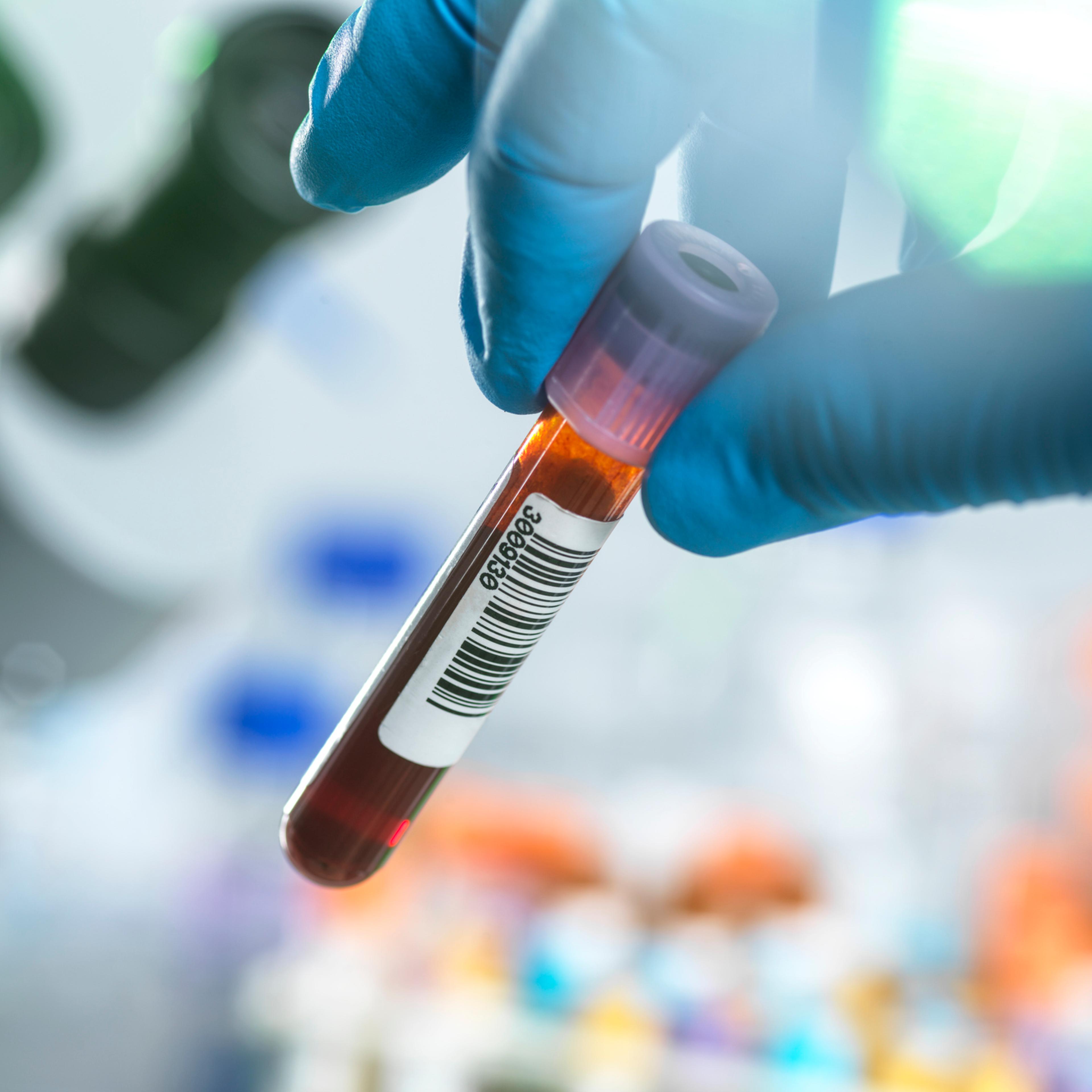 Blood test