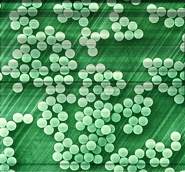 Superparamagnetic microbeads: the monosized Dynabeads