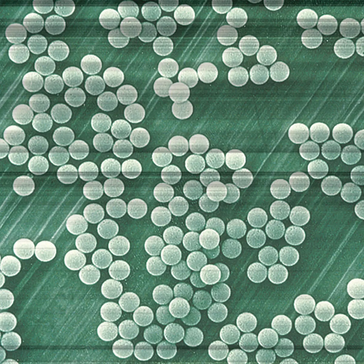 Superparamagnetic microbeads: the monosized Dynabeads
