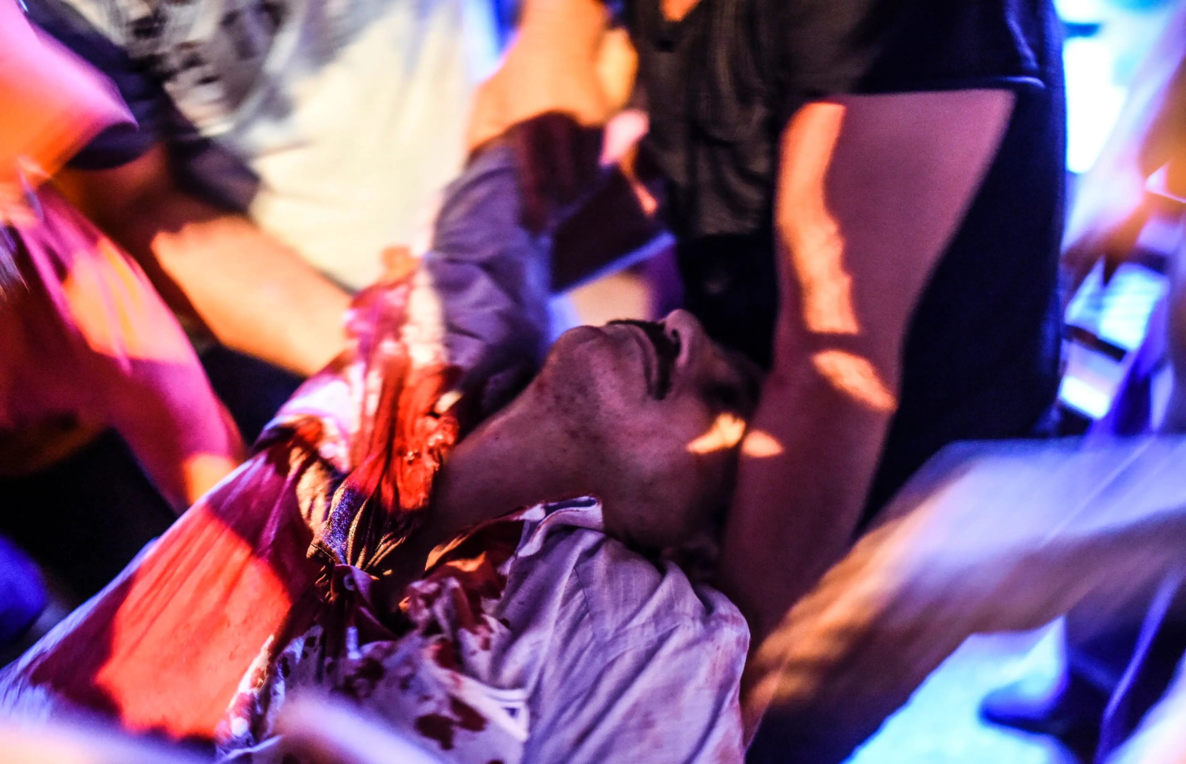 A wounded man is taken away after clashes with the Turkish military at the entrance to the Bosphorus Bridge in Istanbul, Turkey, on July 16, 2016.