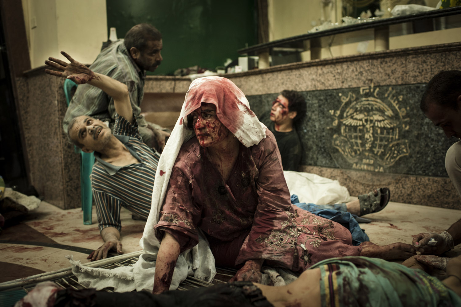 <b>Edouard Elias</b><br><br>
<i>Wounded civilians are seen in a field hospital in Aleppo after an air strike destroyed a bakery, killing 20 and injuring 80.</i><br><br>
"I shot this on the night of Aug. 21. A bakery had been bombed, and cars carried the wounded civilians to Dar al-Shifa Hospital. It was a difficult moment, working among the wounded and dead. It was my first war, and I had the responsibility to make pictures at this moment, even if I wouldn't go inside the hospital. 
<br>Looking back at the picture, I remember how I felt sitting outside the hospital with my emotions, near tears. When fighters were wounded, I understood — it's war. But civilian boys, children, women ... it wasn't the same feeling."