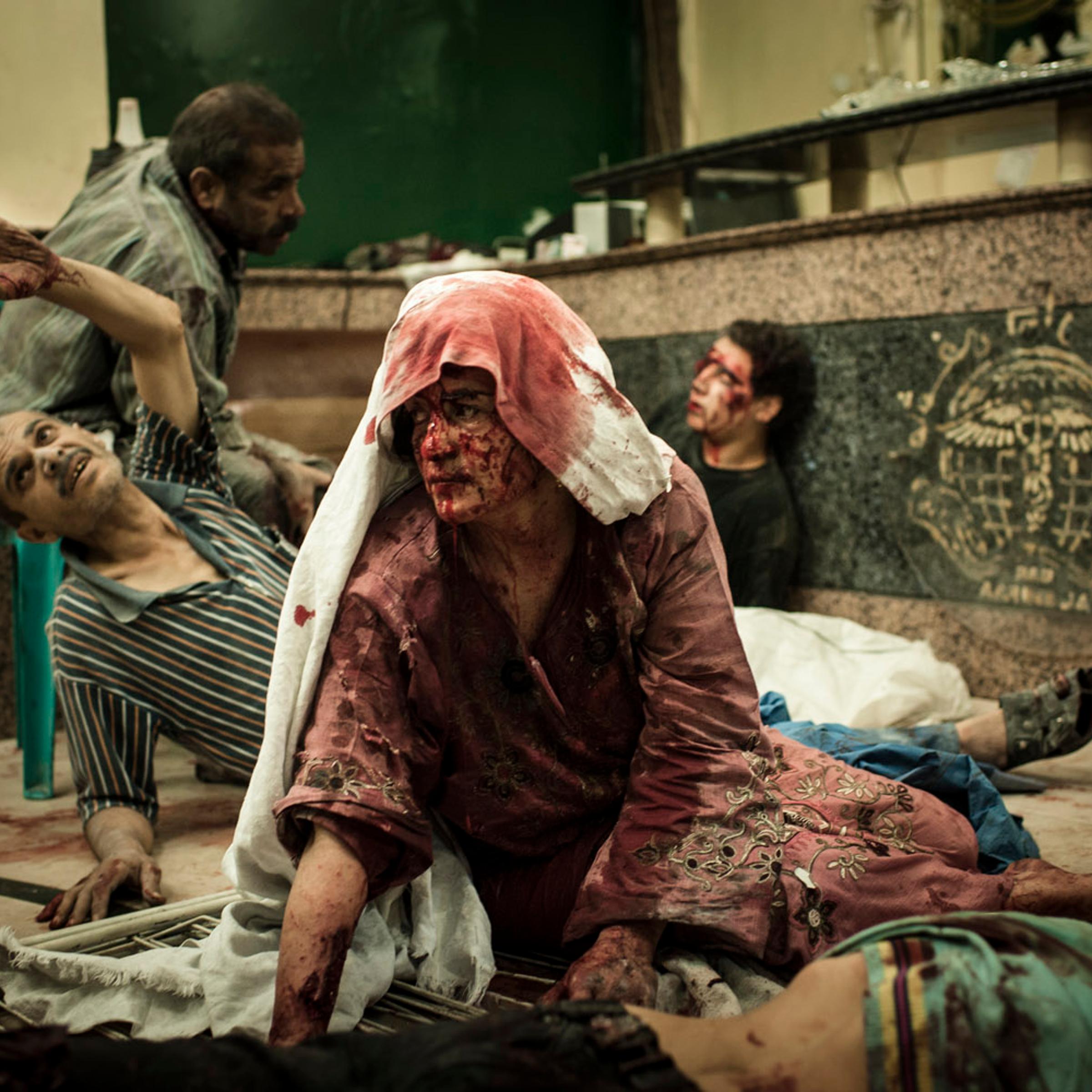 <b>Edouard Elias</b><br><br>
<i>Wounded civilians are seen in a field hospital in Aleppo after an air strike destroyed a bakery, killing 20 and injuring 80.</i><br><br>
"I shot this on the night of Aug. 21. A bakery had been bombed, and cars carried the wounded civilians to Dar al-Shifa Hospital. It was a difficult moment, working among the wounded and dead. It was my first war, and I had the responsibility to make pictures at this moment, even if I wouldn't go inside the hospital.
<br>Looking back at the picture, I remember how I felt sitting outside the hospital with my emotions, near tears. When fighters were wounded, I understood — it's war. But civilian boys, children, women ... it wasn't the same feeling."