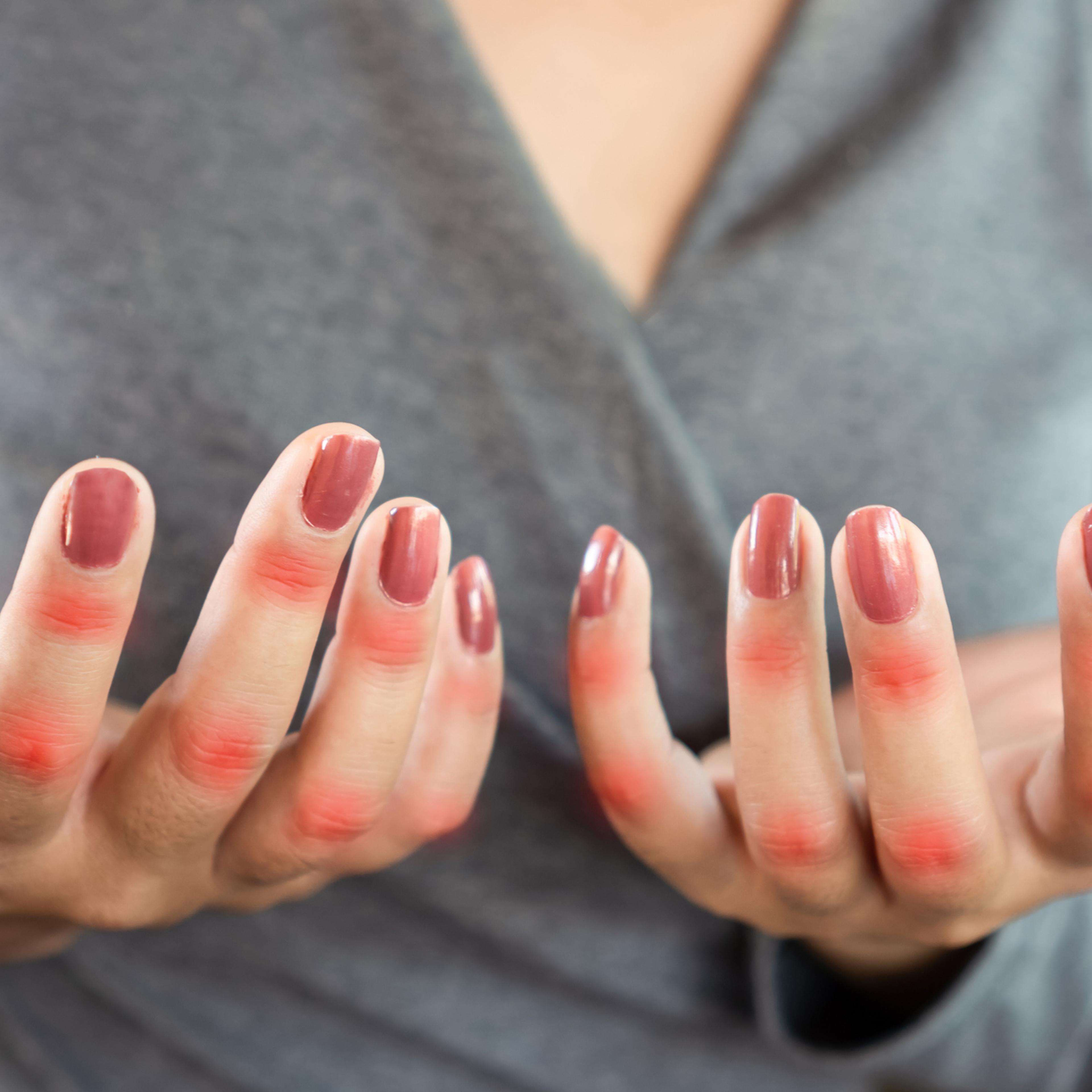 closeup woman suffering from hand and finger pain can be use for knuckle , joint pain and gout concept