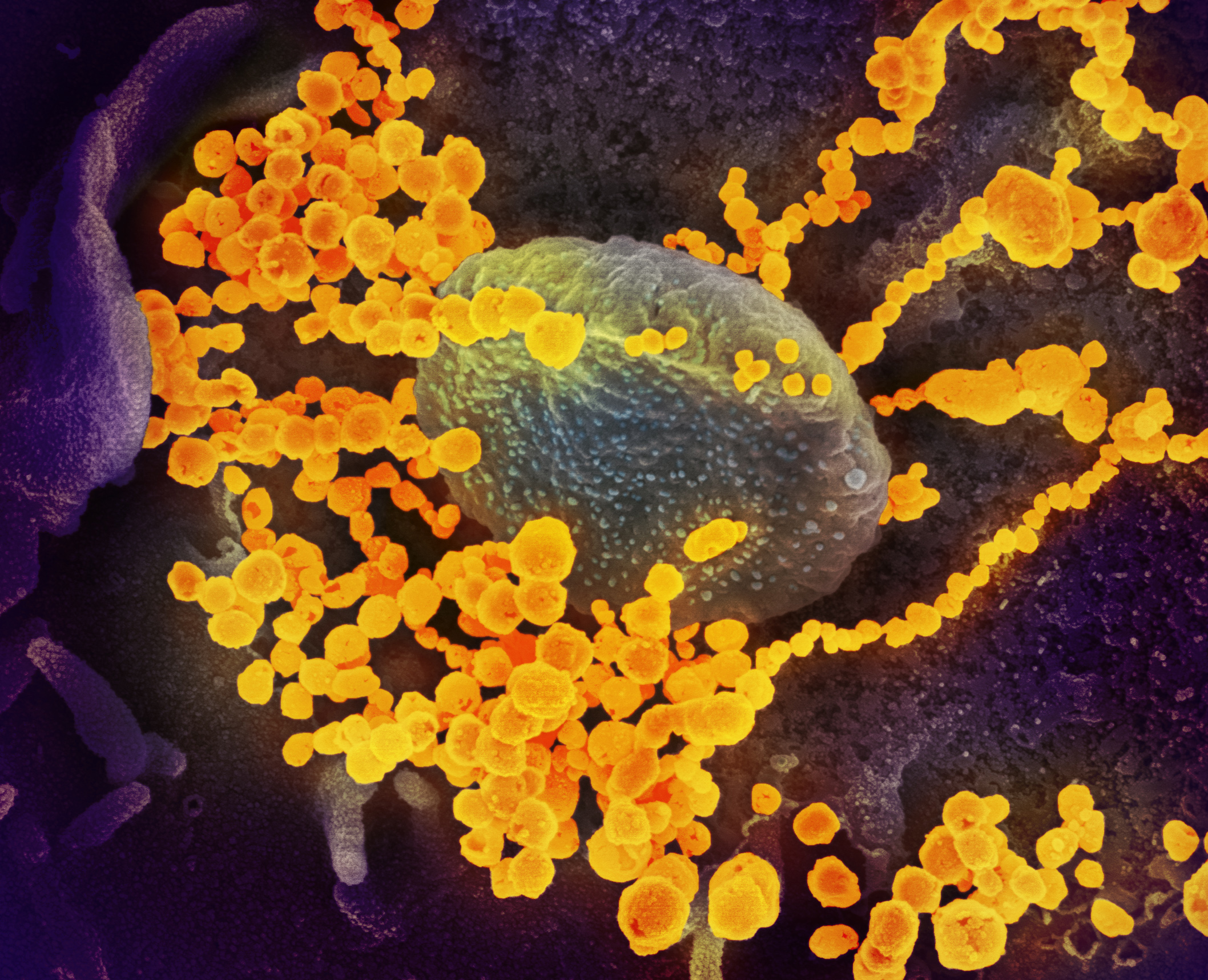 Elizabeth Fischer uses an electron microscope to capture images of the coronavirus, which is  about 10,000 times smaller than the width of a human hair. “I like to get images out there to try to convey that this is an entity, to try to demystify it, so t