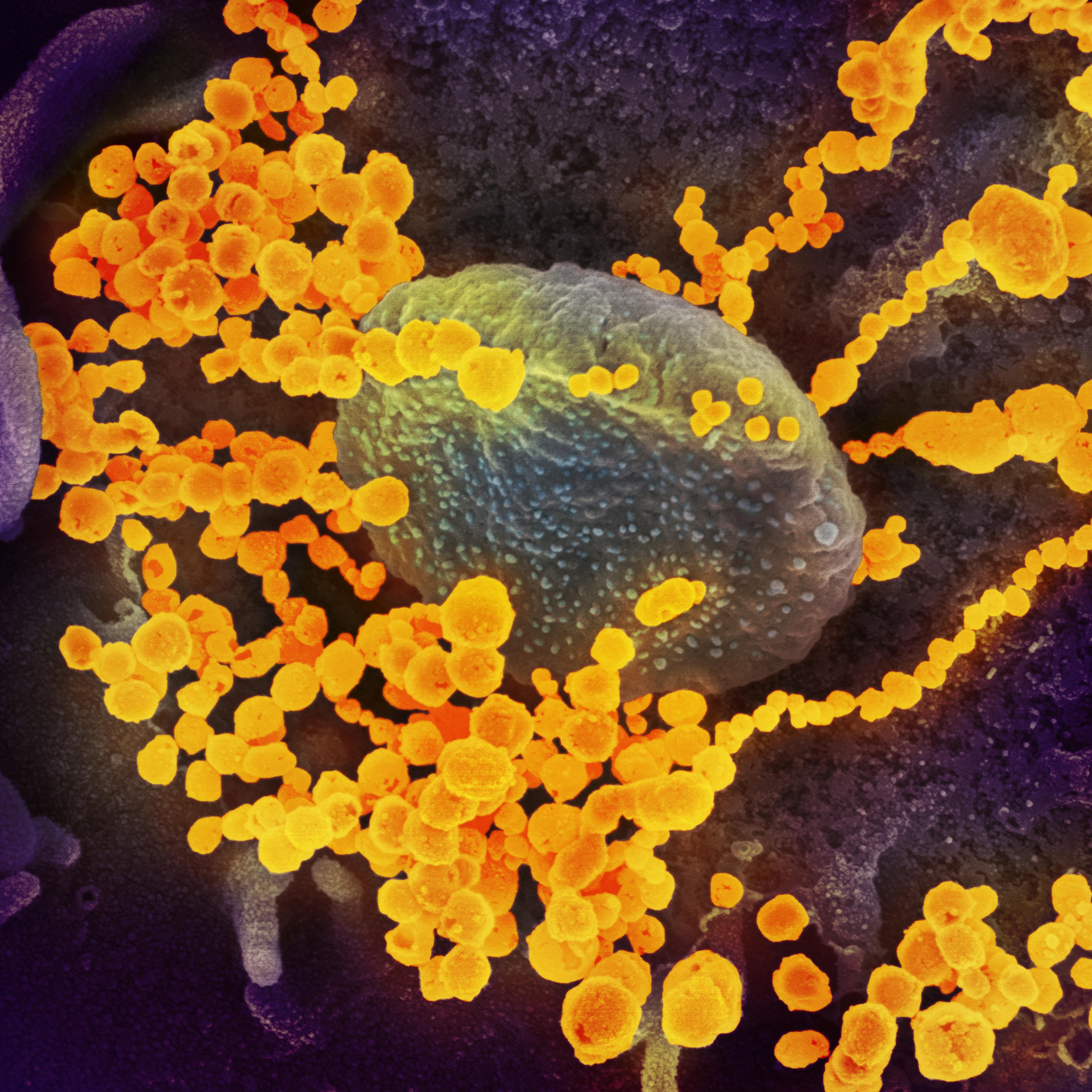 Elizabeth Fischer uses an electron microscope to capture images of the coronavirus, which is about 10,000 times smaller than the width of a human hair. “I like to get images out there to try to convey that this is an entity, to try to demystify it, so t
