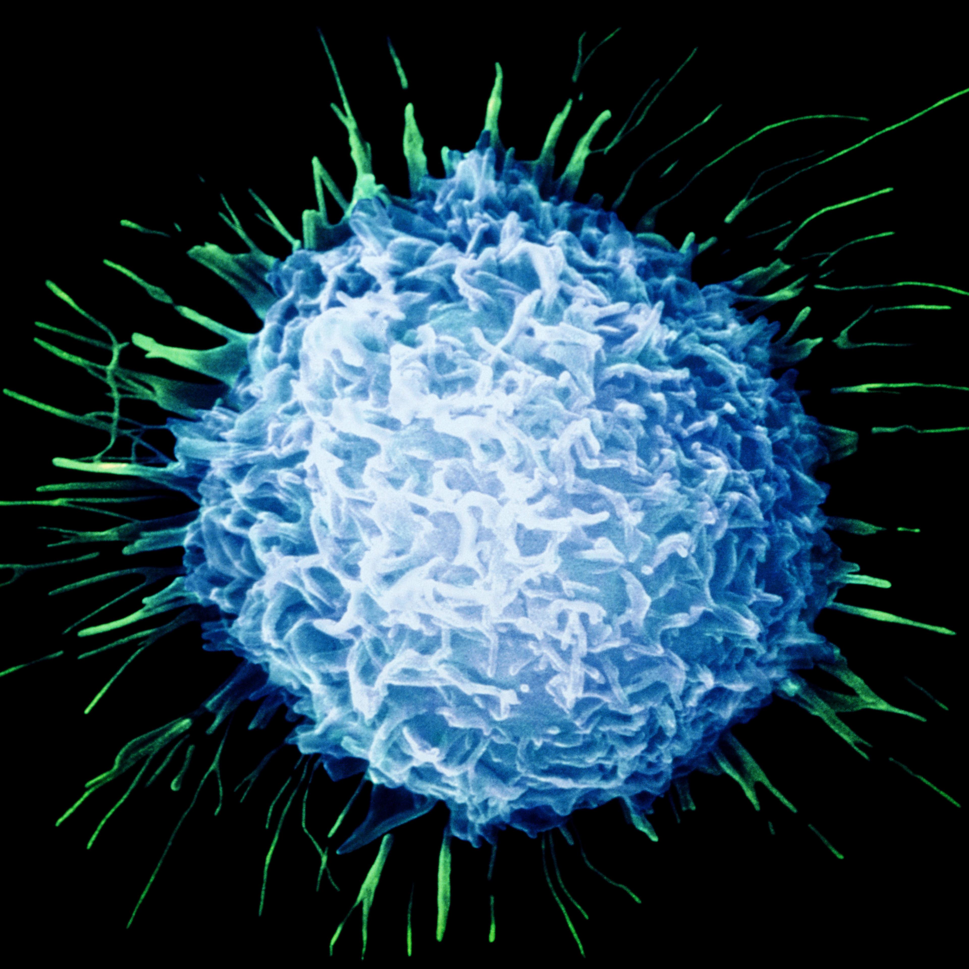 Prostate cancer cell.