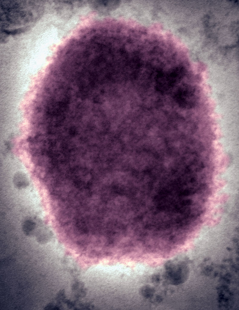 Monkeypox Virus