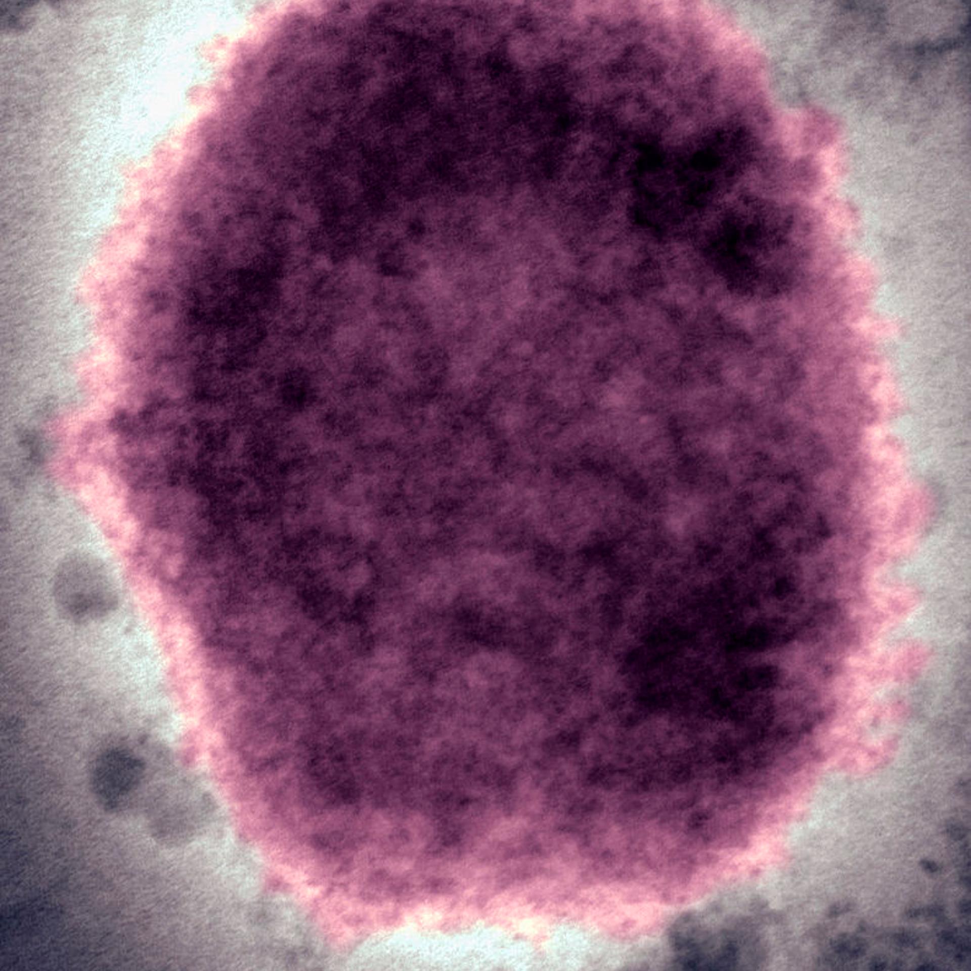 Monkeypox Virus