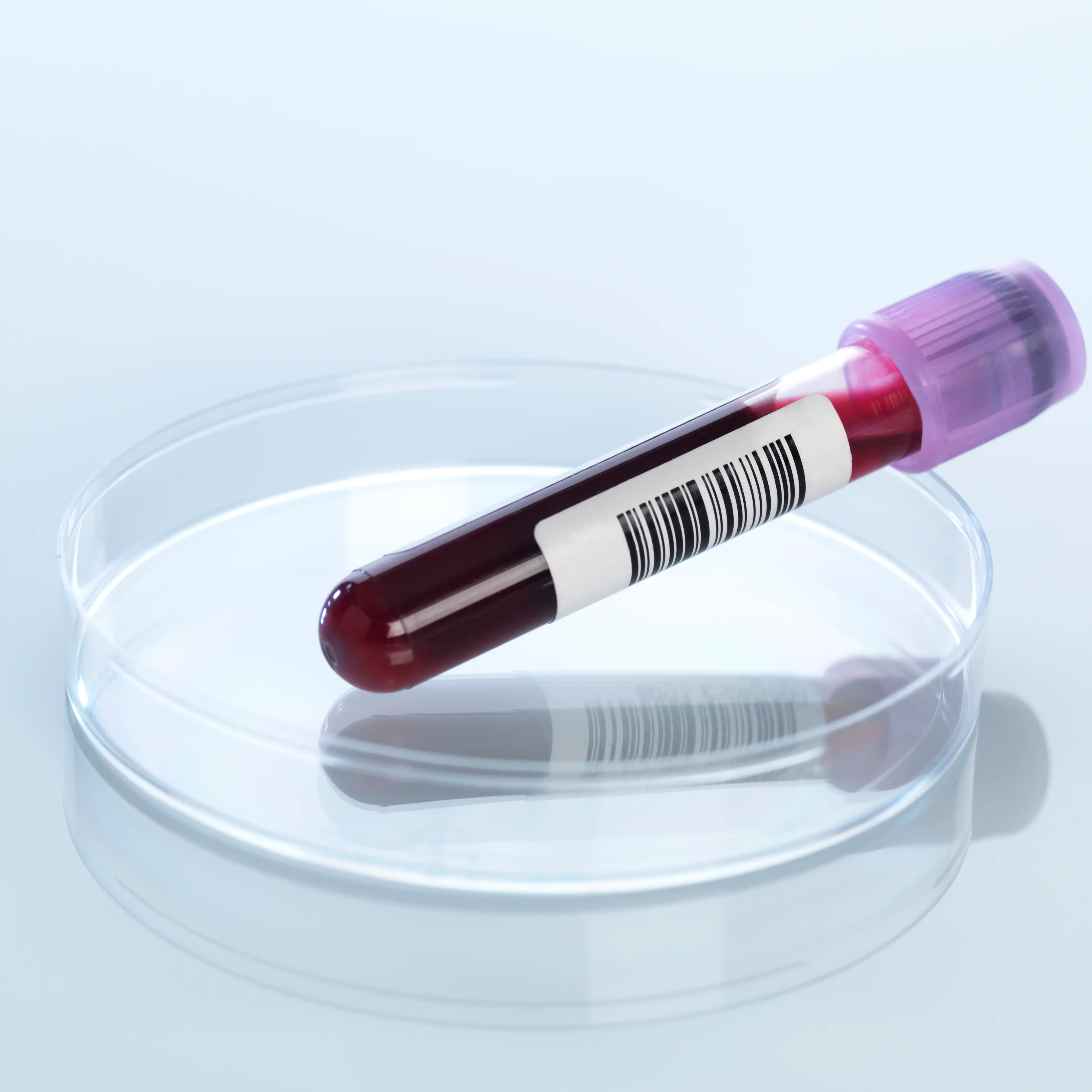 Blood sample in petri dish
