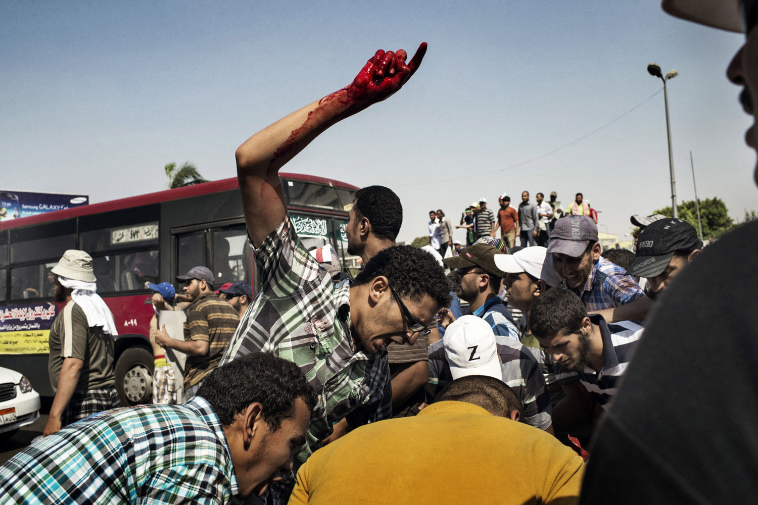Cairo Egypt July 05 2013:Backers of ousted President Mohamed Morsi helped an injured man near Republican Guard headquarters in Cairo.Morci supporters surround a man who has been shot by the military. His name is Mohammed Suphi Mohammed Assayid Ali.He was