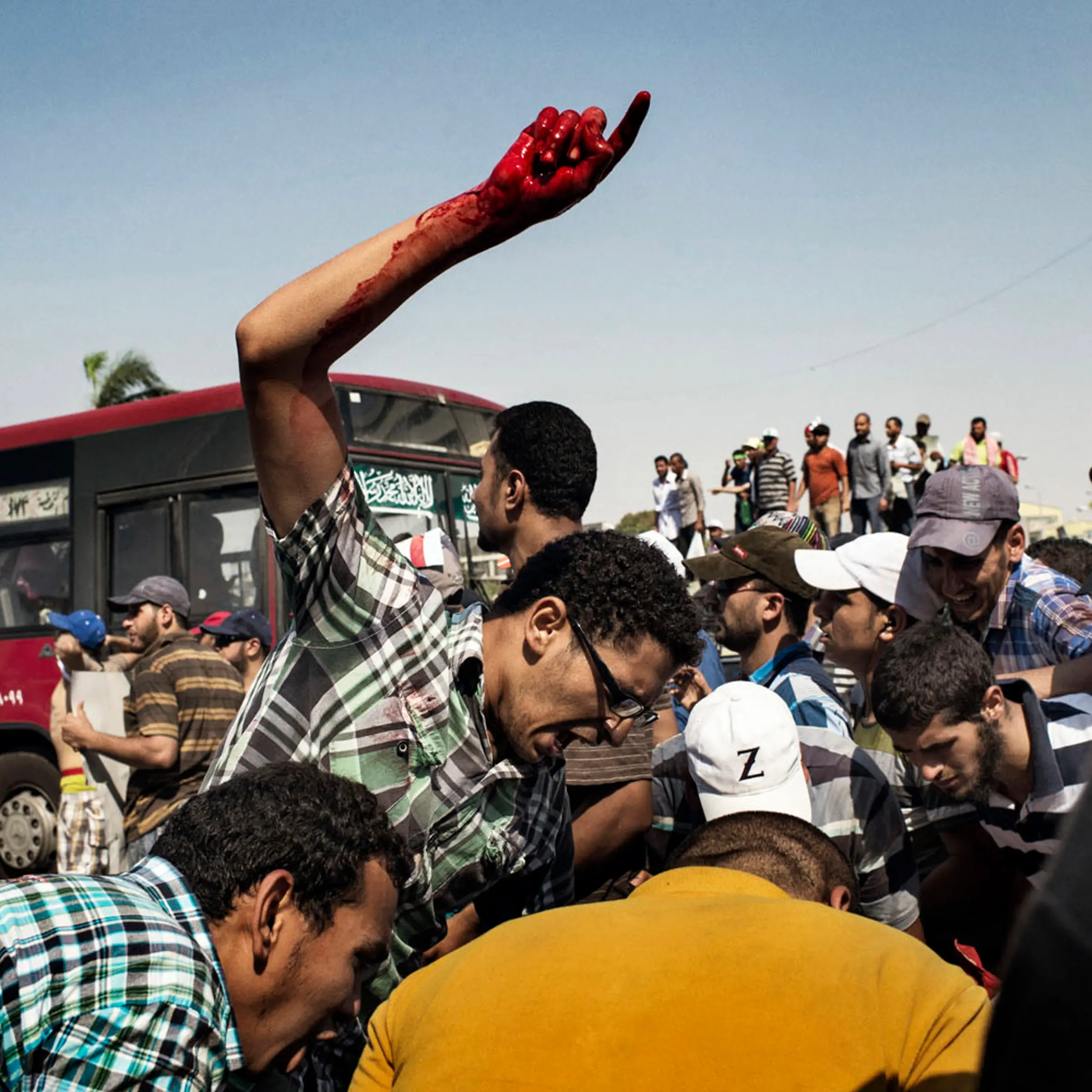 Cairo Egypt July 05 2013:Backers of ousted President Mohamed Morsi helped an injured man near Republican Guard headquarters in Cairo.Morci supporters surround a man who has been shot by the military. His name is Mohammed Suphi Mohammed Assayid Ali.He was