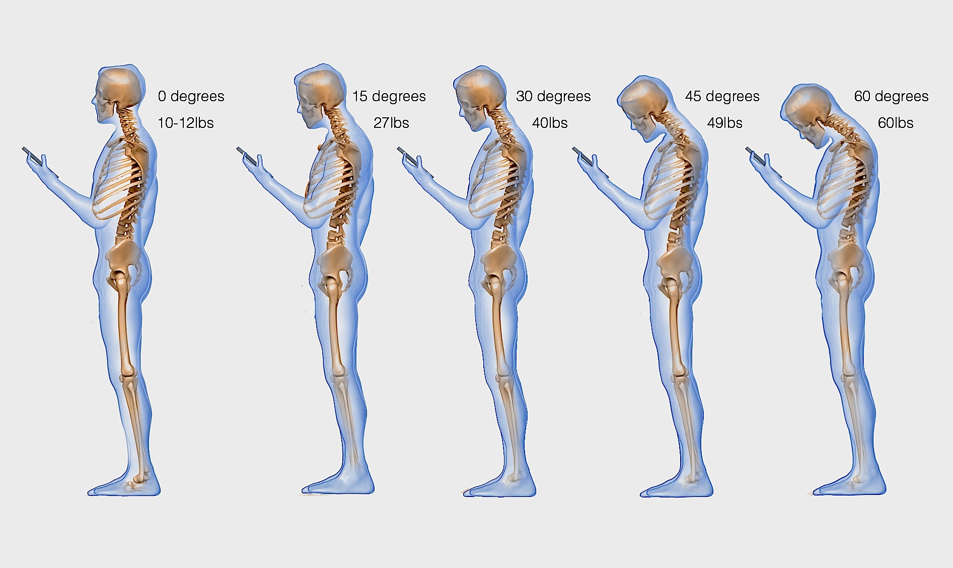 Spine Phone Texting