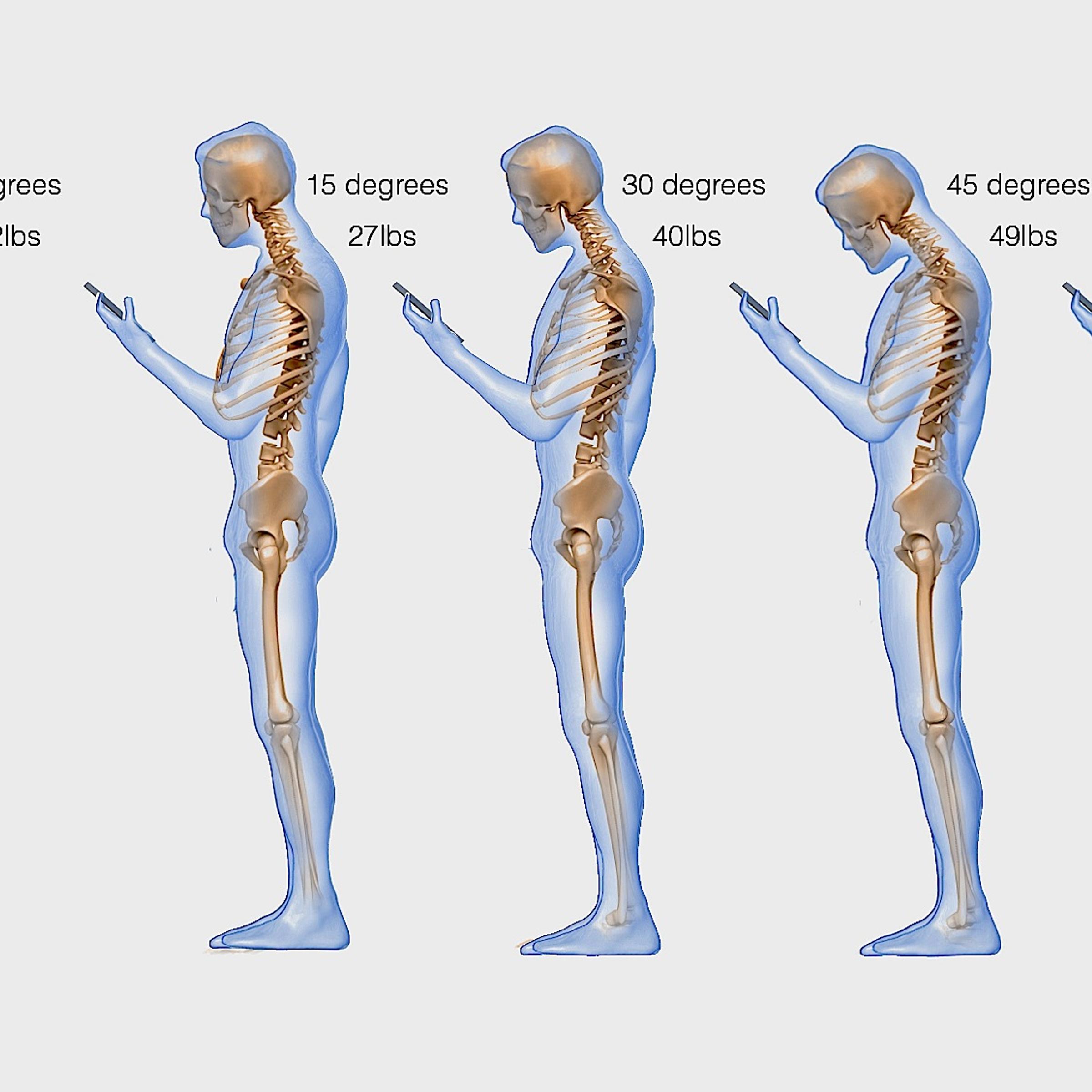 Spine Phone Texting