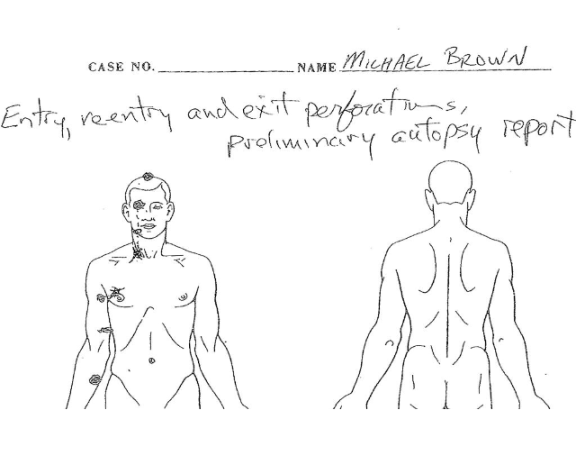 A partial image of Dr. Michael Baden's preliminary autopsy report obtained by NBC News from attorney Anthony Gray, who represents Michael Brown's family.