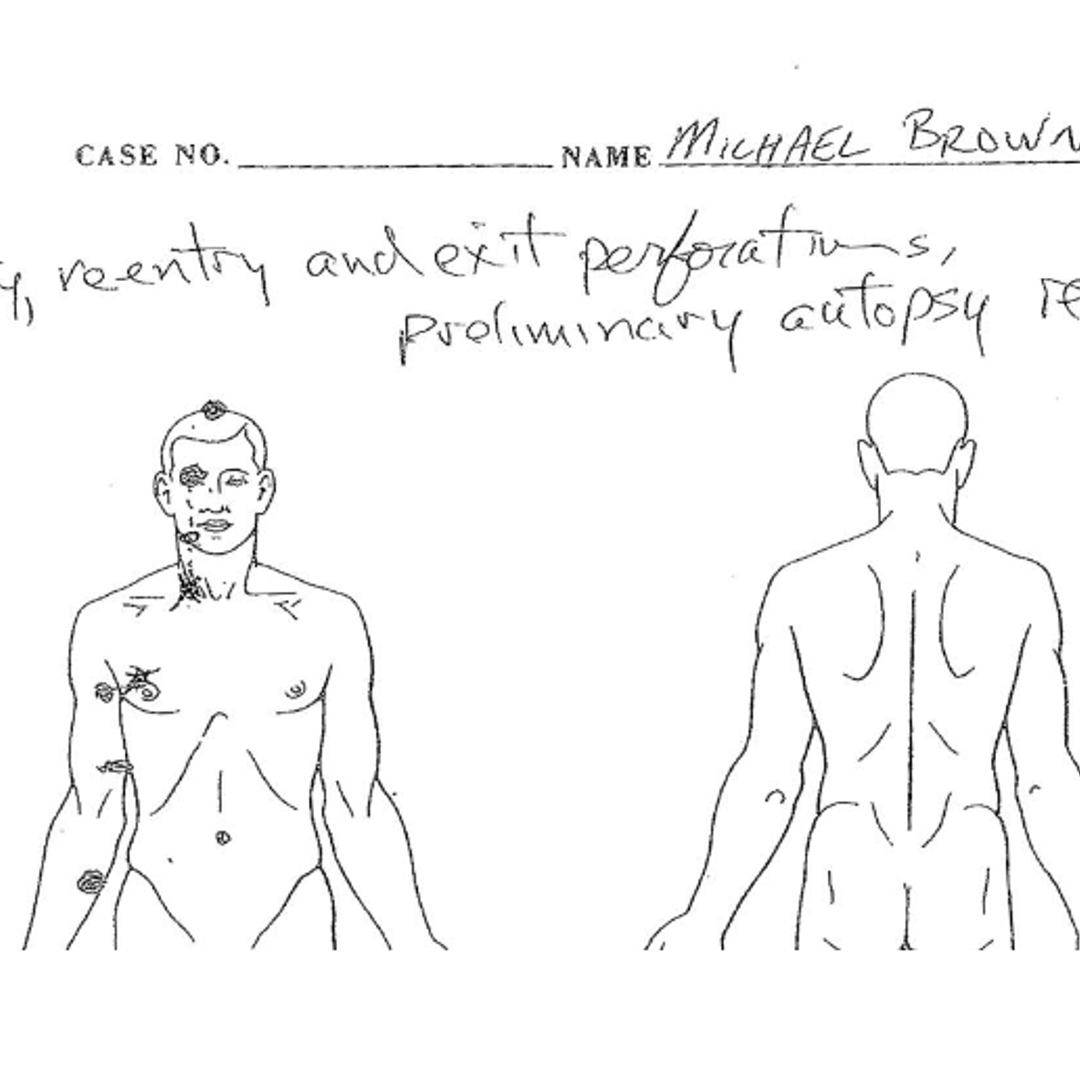 A partial image of Dr. Michael Baden's preliminary autopsy report obtained by NBC News from attorney Anthony Gray, who represents Michael Brown's family.
