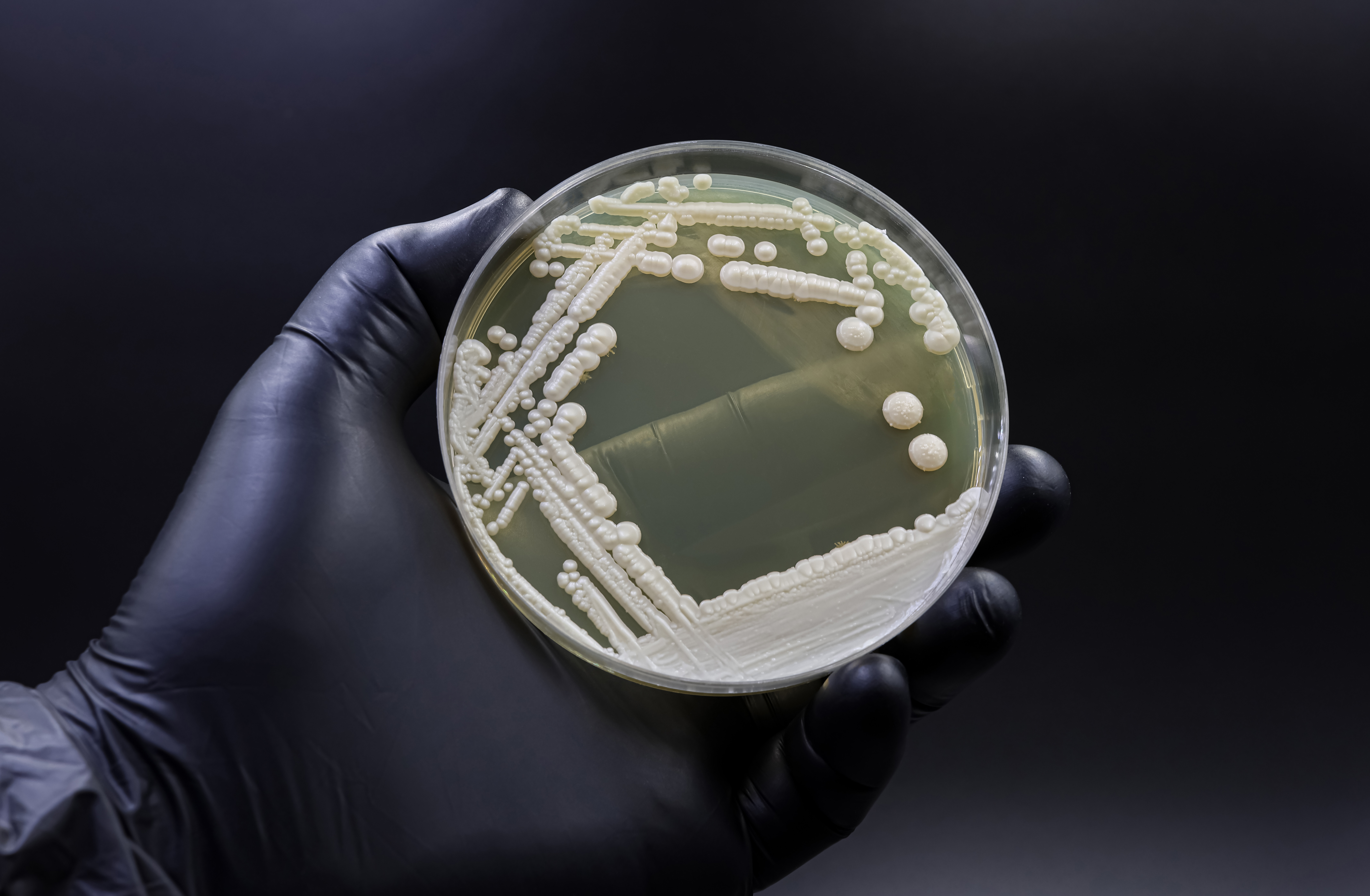Why Dangerous Fungi Are on the Rise