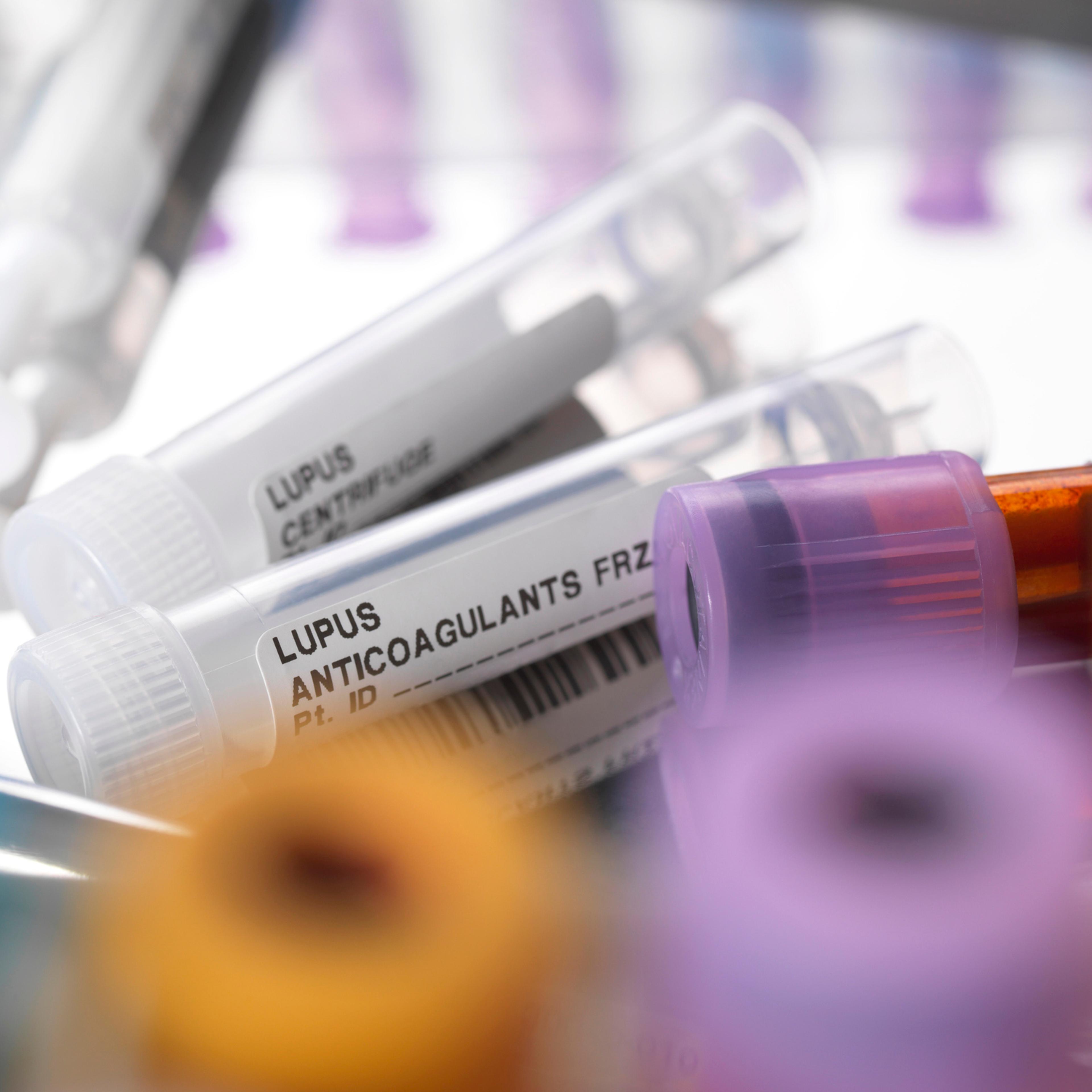 Lupus anticoagulants